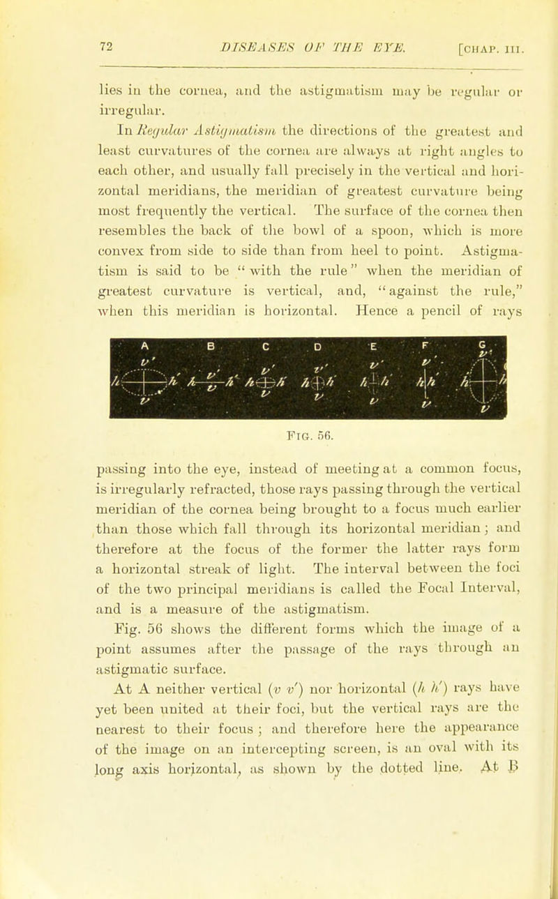 [CHAP. J 1 I . lies iu the cornea, and the astigmatism may be regular or irregular. In Regular Astigmatism the directions of the greatest and least curvatures of the cornea are always at right angles to each other, and usually fall precisely in the vertical and hori- zontal meridians, the meridian of greatest curvature being most frequently the vertical. The surface of the cornea then resembles the back of the bowl of a spoon, which is more convex from side to side than from heel to point. Astigma- tism is said to be  with the rule when the meridian of greatest curvature is vertical, and,  against the rule, when this meridian is horizontal. Hence a pencil of rays Fig. 56. passing into the eye, instead of meeting at a common focus, is irregularly refracted, those rays passing through the vertical meridian of the cornea being brought to a focus much earlier than those which fall through its horizontal meridian ; and therefore at the focus of the former the latter rays form a horizontal streak of light. The interval between the foci of the two principal meridians is called the Focal Interval, and is a measure of the astigmatism. Fig. 56 shows the different forms which the image of a point assumes after the passage of the rays through an astigmatic surface. At A neither vertical (v v) nor horizontal (A h') rays have yet been united at their foci, but the vertical rays are the nearest to their focus ; and therefore here the appearance of the image on an intercepting screen, is an oval with its long axis horizontal, as shown by the dotted line. At B