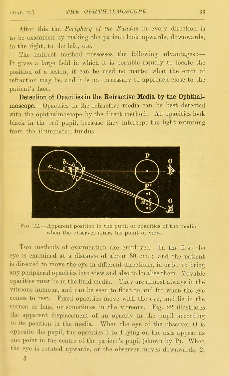 After this the Perifhery of the Fundus in every direction is to be examined by making the patient loolc upwards, downwards, to the right, to the left, etc. The indu-ect method possesses the following advantages :— It gives a large field in which it is possible rapidly to locate the position of a lesion, it can be used no matter what the error of lefi'action may be, and it is not necessary to approach close to the patient's face. Detection of Opacities in the Refractive Media by the Ophthal- moscope.—Opacities in the refractive media can be best detected with the ophthalmoscope by the direct method. All opacities look black in the red pupil, because they intercept the light returning from the illuminated fundus. p \ 9 A >L / - ^^^^ 0 Fig. 22.—Apparent position in the pupil of ox^acities of the media when the observer alters his point of view. Two methods of examination are employed. In the first the eye is examined at a distance of about 30 cm. ; and the patient is directed to move the eye in difierent directions, in order to bring any peripheral opacities into view and also to localise them. Movable opacities must lie in the fluid media. They are almost always in the vitreous humour, and can be seen to float to and fro when the eye comes to rest. Fixed opacities move with the eye, and lie in the cornea or lens, or sometimes in the vitreous. Fig. 22 illustrates the apparent displacement of an opacity in the pupil according to its position in the media. When the eye of the observer 0 is opposite the pupil, the opacities 1 to 4 lying on the axis appear as one point in the centre of the patient's pupil (shown by P). When the eye is rotated upwards, or the observer moves downwards, 2, 3
