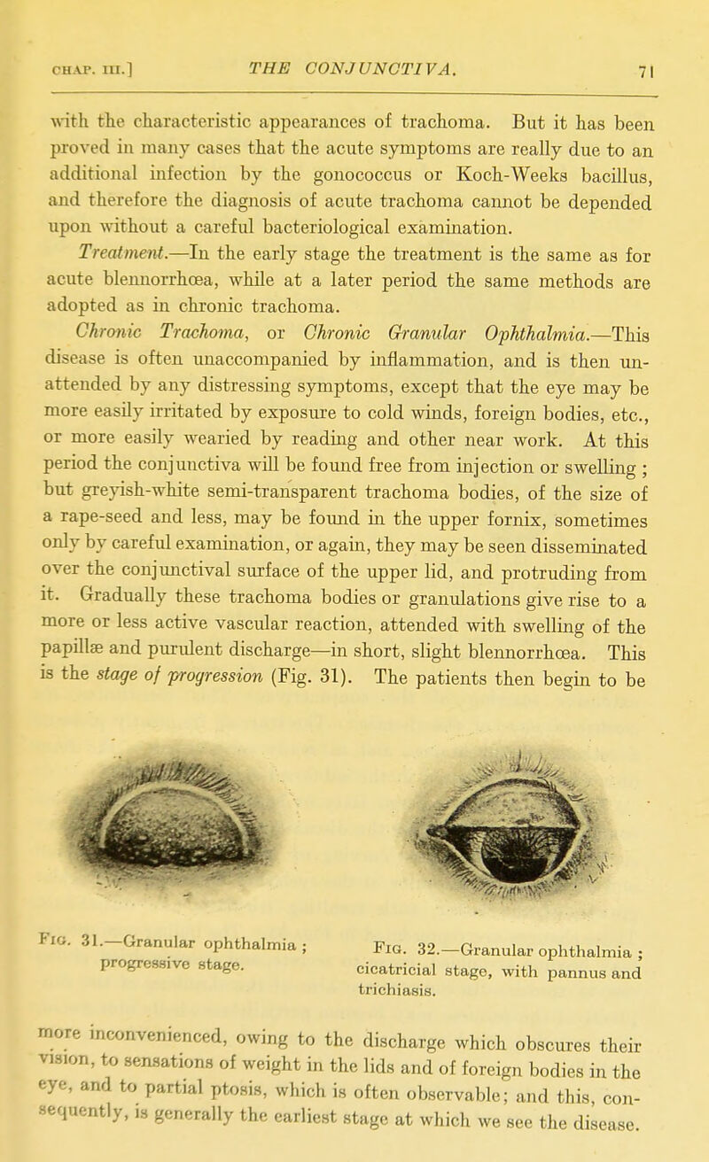 with the characteristic appearances of trachoma. But it has been proved in many cases that the acute symptoms are really due to an additional infection by the gonococcus or Koch-Weeks bacillus, and therefore the diagnosis of acute trachoma cannot be depended upon ^\•ithout a careful bacteriological examination. Treatment.—In the early stage the treatment is the same as for acute blennorrhcea, while at a later period the same methods are adopted as in chronic trachoma. Chronic Trachoma, or Chronic Granular Ophthalmia.—This disease is often unaccompanied by inflammation, and is then un- attended by any distressing symptoms, except that the eye may be more easily irritated by exposure to cold winds, foreign bodies, etc., or more easily wearied by reading and other near work. At this period the conjunctiva will be found free from injection or swelling ; but greyish-white semi-transparent trachoma bodies, of the size of a rape-seed and less, may be foimd in the upper fornix, sometimes only by careful examination, or again, they may be seen disseminated over the conjunctival surface of the upper lid, and protruding from it. Gradually these trachoma bodies or granulations give rise to a more or less active vascular reaction, attended with swelling of the papillae and purulent discharge—in short, slight blennorrhcea. This is the stage of progression (Fig. 31). The patients then begin to be Fig. 31.—Granular ophthalmia ; progressive stage. Fig. 32.—Granular ophthalmia ; cicatricial stage, with pannus and trichiasis. more mconvenienced, owing to the discharge which obscures their vision, to sensations of weight in the lids and of foreign bodies in the eye, and to partial ptosis, which is often observable; and this, con- sequently, IS generally the earliest stage at which we see the disease