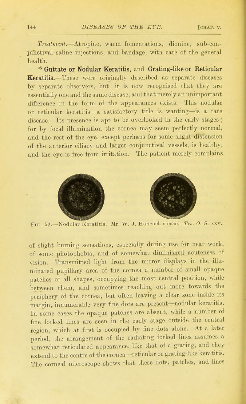 Treatment.—Atropine, warm fomentations, dionine, sub-con- junctival saline injections, and bandage, witli care of the general health. * Guttate or Nodular Keratitis, and Grating-like or Reticular Keratitis.—These were originally described as separate diseases by separate observers, but it is now recognised that they are essentially one and the same disease, and that merely an unimportant difference in the form of the appearances exists. This nodular or reticular keratitis—a satisfactory title is wanting—is a rare disease. Its presence is apt to be overlooked in the early stages ; for by focal illumination the cornea may seem perfectly normal, and the rest of the eye, except perhaps for some slight distension of the anterior ciliary and larger conjunctival vessels, is healthy, and the eye is free from irritation. The patient merely complains Fig. 52.—Nodular Keratitis. Mr. W. J. Hancock s case. 'I'rs. O. S. xxv. of slight burning sensations, especially during use for near work, of some photophobia, and of somewhat diminished acuteuess of vision. Transmitted light from the mirror displays in the illu- minated pupillary area of the cornea a number of small opaque patches of all shapes, occupying the most central position, while between them, and sometimes reaching out more towards the periphery of the cornea, but often leaving a clear zone inside its margin, innumerable very fine dots are present—nodular keratitis. In some cases the opaque patches are absent, while a number of fine forked lines are seen in the early stage outside the central region, which at first is occupied by fine dots alone. At a later period, the arrangement of the radiating forked lines assumes a somewhat reticulated appearance, like that of a grating, and they extend to the centre of the cornea—reticular or grating-like keratitis. The corneal microscope shows that these dots, patclies, and hues