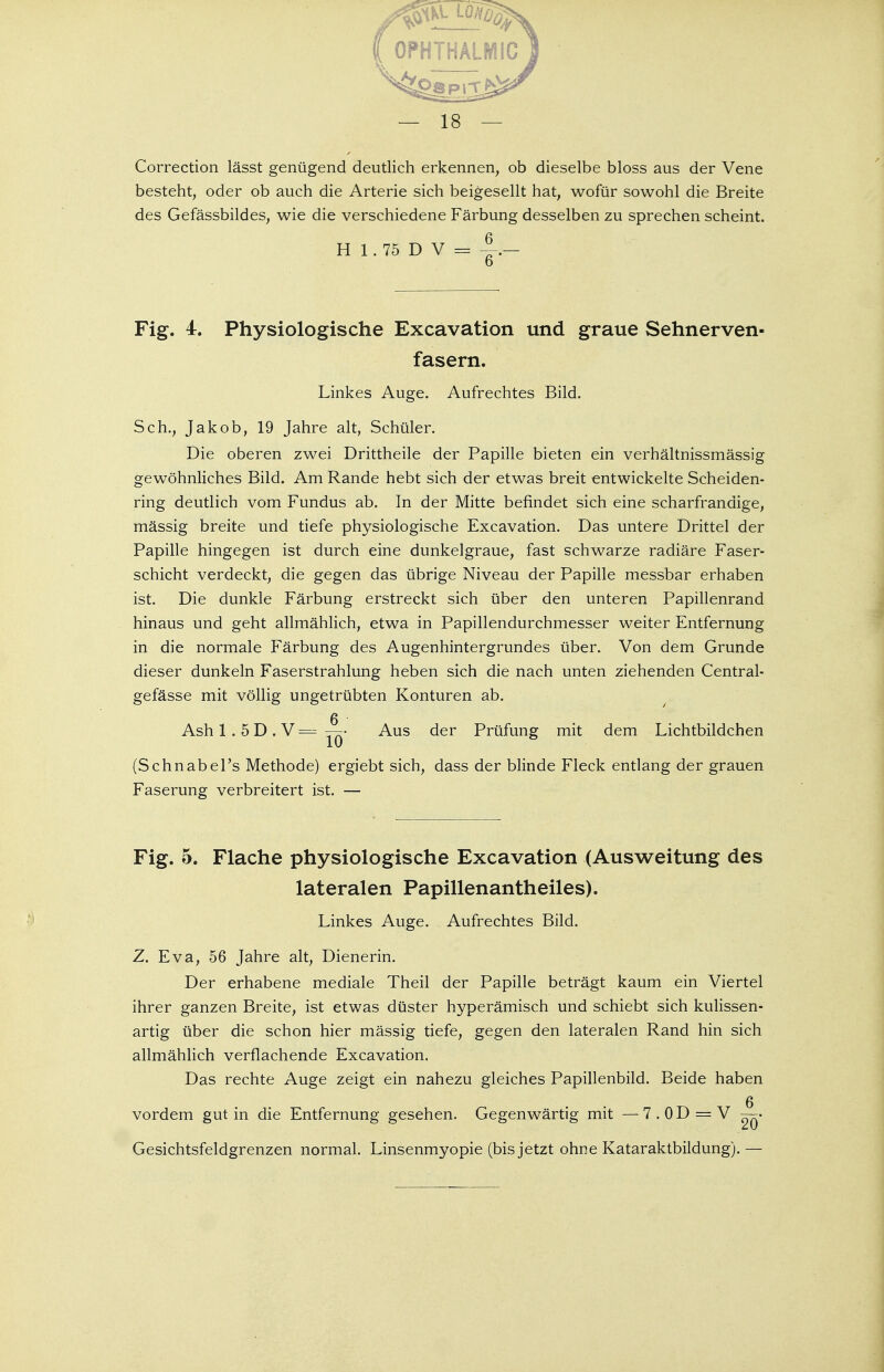 Correction lässt genügend deutlich erkennen, ob dieselbe bloss aus der Vene besteht, oder ob auch die Arterie sich beigesellt hat, wofür sowohl die Breite des Gefässbildes, wie die verschiedene Färbung desselben zu sprechen scheint. H 1. 75 D V = 4 — Fig. 4. Physiologische Excavation und graue Sehnerven- fasern. Linkes Auge. Aufrechtes Bild. Sch., Jakob, 19 Jahre alt, Schüler. Die oberen zwei Drittheile der Papille bieten ein verhältnissmässig gewöhnliches Bild. Am Rande hebt sich der etwas breit entwickelte Scheiden- ring deutlich vom Fundus ab. In der Mitte befindet sich eine scharfrandige, mässig breite und tiefe physiologische Excavation. Das untere Drittel der Papille hingegen ist durch eine dunkelgraue, fast schwarze radiäre Faser- schicht verdeckt, die gegen das übrige Niveau der Papille messbar erhaben ist. Die dunkle Färbung erstreckt sich über den unteren Papillenrand hinaus und geht allmählich, etwa in Papillendurchmesser weiter Entfernung in die normale Färbung des Augenhintergrundes über. Von dem Grunde dieser dunkeln Faserstrahlung heben sich die nach unten ziehenden Central- gefässe mit völlig ungetrübten Konturen ab. 6 ■ Ash 1 . 5 D . V = — • Aus der Prüfung mit dem Lichtbildchen (Schnabel's Methode) ergiebt sich, dass der blinde Fleck entlang der grauen Faserung verbreitert ist. — Fig. 5. Flache physiologische Excavation (Ausweitung des lateralen Papillenantheiles). Linkes Auge. Aufrechtes Bild. Z. Eva, 56 Jahre alt, Dienerin. Der erhabene mediale Theil der Papille beträgt kaum ein Viertel ihrer ganzen Breite, ist etwas düster hyperämisch und schiebt sich kulissen- artig über die schon hier mässig tiefe, gegen den lateralen Rand hin sich allmählich verflachende Excavation. Das rechte Auge zeigt ein nahezu gleiches Papillenbild. Beide haben vordem gut in die Entfernung gesehen. Gegenwärtig mit — 7 . 0 D = V —• Gesichtsfeldgrenzen normal. Linsenmyopie (bis jetzt ohne Kataraktbildung).—