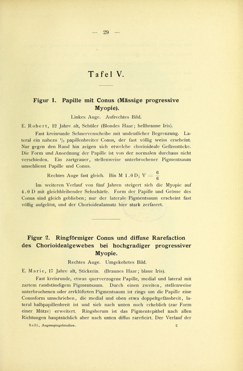 Figur 1. Papille mit Conus (Mässige progressive Myopie). Linkes Auge. Aufrechtes Bild. E. Robert, 12 Jahre alt, Schüler (Blondes Haar; hellbraune Iris). Fast kreisrunde Sehnervenscheibe mit undeutlicher Begrenzung. La- teral ein nahezu */2 papillenbreiter Conus, der fast völlig weiss erscheint. Nur gegen den Rand hin zeigen sich etwelche chorioideale Gefässstücke. Die Form und Anordnung der Papille ist von der normalen durchaus nicht verschieden. Ein zartgrauer, stellenweise unterbrochener Pigmentsaum umschliesst Papille und Conus. 6 Rechtes Auge fast gleich. Bin M 1.0D; V = - D Im weiteren Verlauf von fünf Jahren steigert sich die Myopie auf 4.0 D mit gleichbleibender Sehschärfe. Form der Papille und Grösse des Conus sind gleich geblieben; nur der laterale Pigmentsaum erscheint fast völlig aufgelöst, und der Chorioidealansatz hier stark zerfasert. Figur 2. Ringförmiger Conus und diffuse Rarefaction des Chorioidealgewebes bei hochgradiger progressiver Myopie. Rechtes Auge. Umgekehrtes Bild. E. Marie, 17 Jahre alt, Stickerin. (Braunes Haar; blaue Iris). Fast kreisrunde, etwas querverzogene Papille, medial und lateral mit zartem randständigem Pigmentsaum. Durch einen zweiten, stellenweise unterbrochenen oder zerklüfteten Pigmentsaum ist rings um die Papille eine Conusform umschrieben, die medial und oben etwa doppeltgefässbreit, la- teral halbpapillenbreit ist und sich nach unten noch erheblich (zur Form einer Mütze) erweitert. Ringsherum ist das Pigmentepithel nach allen Richtungen hauptsächlich aber nach unten diffus rareficirt. Der Verlauf der