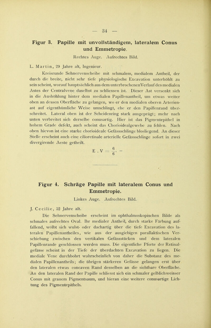 — 34 — Figur 3. Papille mit unvollständigem, lateralem Conus und Emmetropie. Rechtes Auge. Aufrechtes Bild. L. Martin, 29 Jahre alt, Ingenieur. Kreisrunde Sehnervenscheibe mit schmalem, medialem Antheil, der durch die breite, nicht sehr tiefe physiologische Excavation unterhöhlt zu sein scheint, worauf hauptsächlich aus dem unterbrochenen Verlauf des medialen Astes der Centraivene daselbst zu schliessen ist. Dieser Ast versenkt sich in die Aushöhlung hinter dem medialen Papillenantheil, um etwas weiter oben an dessen Oberfläche zu gelangen, wo er den medialen oberen Arterien- ast auf eigenthümliche Weise umschlingt, ehe er den Papillenrand über- schreitet. Lateral oben ist der Scheidenring stark ausgeprägt; mehr nach unten verbreitet sich derselbe conusartig. Hier ist das Pigmentepithel in hohem Grade defekt, auch scheint das Chorioidealgewebe zu fehlen. Nach oben hievon ist eine starke chorioideale Gefässschlinge blosliegend. An dieser Stelle erscheint auch eine cilioretinale arterielle Gelassschlinge sofort in zwei divergirende Aeste getheilt. e . v ••, 6 Figur 4. Schräge Papille mit lateralem Conus und Emmetropie. Linkes Auge. Aufrechtes Bild. J. Cecilie, 52 Jahre alt. Die Sehnervenscheibe erscheint im ophthalmoskopischen Bilde als schmales aufrechtes Oval. Ihr medialer Antheil, durch starke Färbung auf- fallend, wölbt sich wulst- oder dachartig über die tiefe Excavation des la- teralen Papillenantheiles, wie aus der ausgiebigen parallaktischen Ver- schiebung zwischen den vertikalen Gefässstücken und dem lateralen Papillenrande geschlossen werden muss. Die eigentliche Pforte der Retinal- gefässe scheint in der Tiefe der überdachten Excavation zu liegen. Die mediale Vene durchbohrt wahrscheinlich von daher die Substanz des me- dialen Papillenantheils; die übrigen stärkeren Gefässe gelangen erst über den lateralen etwas concaven Rand desselben an die sichtbare Oberfläche. An den lateralen Rand der Papille schliesst sich ein schmaler gelblichweisser Conus mit grauem Pigmentsaum, und hieran eine weitere conusartige Lich- tung des Pigmentepithels.