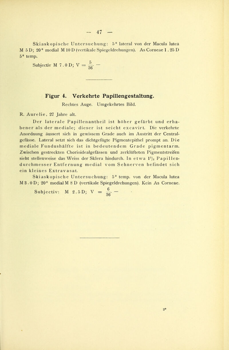 Skiaskopische Untersuchung: 5° lateral von der Macula lutea M 5 D; 20 0 medial M 10 D (vertikale Spiegeldrehungen). As Corneae 1 . 25 D 5° temp. Subjectiv M 7 .0 D; V = ~- — Figur 4. Verkehrte Papillenge staltung. Rechtes Auge. Umgekehrtes Bild. R. Aurelie, 27 Jahre alt. Der laterale Papillenantheil ist höher gefärbt und erha- bener als der mediale; dieser ist seicht excavirt. Die verkehrte Anordnung äussert sich in gewissem Grade auch im Austritt der Central- gefässe. Lateral setzt sich das dichtgefügte Pigmentepithel prompt an. Die mediale Fundushälfte ist in bedeutendem Grade pigmentarm. Zwischen gestreckten Chorioidealgefässen und zerklüfteten Pigmentstreifen sieht stellenweise das Weiss der Sklera hindurch. In etwa P/2 Papillen- durchmesser Entfernung medial vom Sehnerven befindet sich ein kleines Extravasat. Skiaskopische Untersuchung: 5° temp. von der Macula lutea M3.0D; 20° medial M 8 D (vertikale Spiegeldrehungen). Kein As Corneae. Subjectiv: M 2.5D; V = ~. — 3*