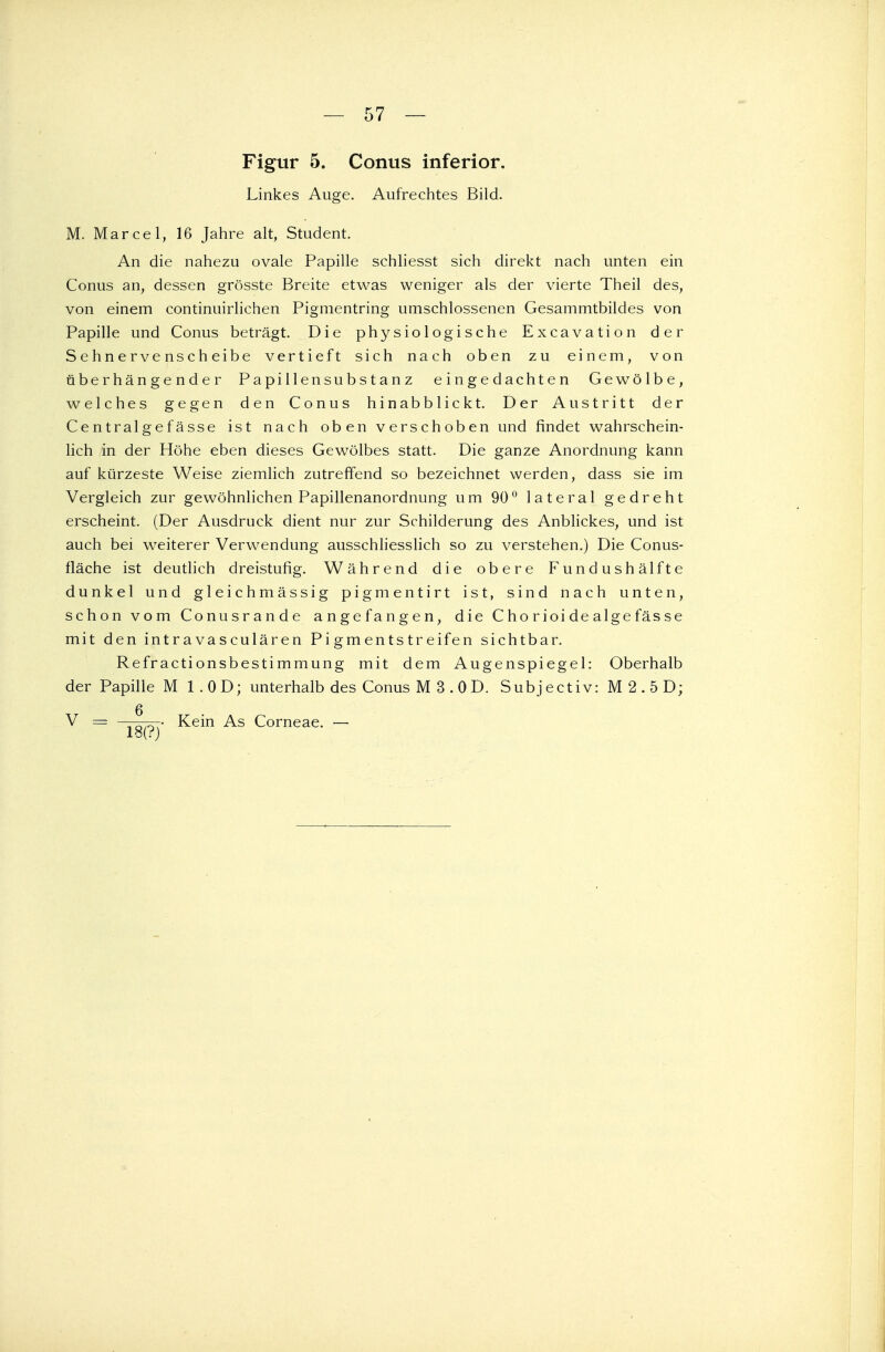 57 — Figur 5. Conus inferior. Linkes Auge. Aufrechtes Bild. M. Marcel, 16 Jahre alt, Student. An die nahezu ovale Papille schliesst sich direkt nach unten ein Conus an, dessen grösste Breite etwas weniger als der vierte Theil des, von einem continuirlichen Pigmentring umschlossenen Gesammtbildes von Papille und Conus beträgt. Die physiologische Excavation der Sehnervenscheibe vertieft sich nach oben zu einem, von überhängender Papillensubstanz eingedachten Gewölbe, welches gegen den Conus hinabblickt. Der Austritt der Centralgefässe ist nach oben verschoben und findet wahrschein- lich in der Höhe eben dieses Gewölbes statt. Die ganze Anordnung kann auf kürzeste Weise ziemlich zutreffend so bezeichnet werden, dass sie im Vergleich zur gewöhnlichen Papillenanordnung um 90° lateral gedreht erscheint. (Der Ausdruck dient nur zur Schilderung des Anblickes, und ist auch bei weiterer Verwendung ausschliesslich so zu verstehen.) Die Conus- fläche ist deutlich dreistufig. Während die obere Fundushälfte dunkel und gleichmässig pigmentirt ist, sind nach unten, schon vom Conusrande angefangen, die C ho rioi de alge fäs se mit den intravasculären Pigmentstreifen sichtbar. Refractionsbestimmung mit dem Augenspiegel: Oberhalb der Papille M 1 .OD; unterhalb des Conus M 3 . 0 D. Subjectiv: M 2 . 5 D;