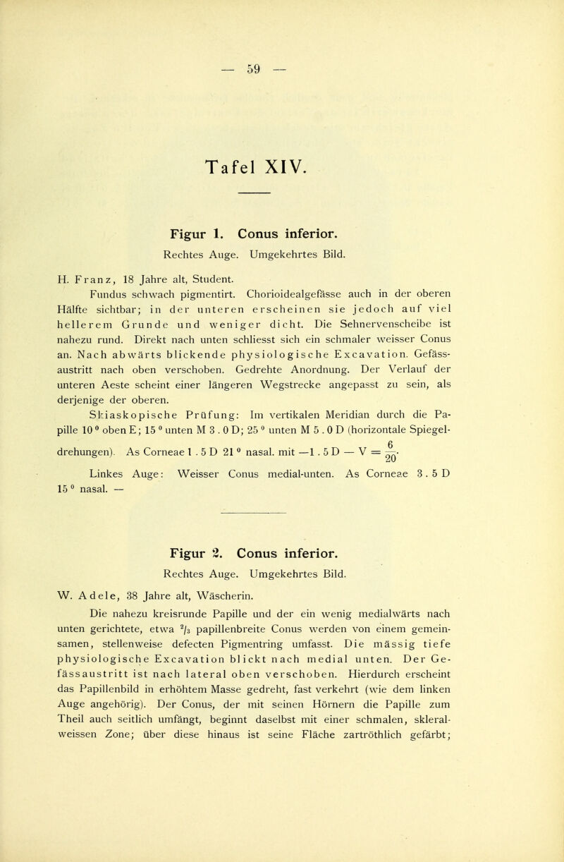 Tafel XIV. Figur 1. Conus inferior. Rechtes Auge. Umgekehrtes Bild. H. Franz, 18 Jahre alt, Student. Fundus schwach pigmentirt. Chorioidealgefässe auch in der oberen Hälfte sichtbar; in der unteren erscheinen sie jedoch auf viel hellerem Grunde und weniger dicht. Die Sehnervenscheibe ist nahezu rund. Direkt nach unten schliesst sich ein schmaler weisser Conus an. Nach abwärts blickende physiologische Excavation. Gefäss- austritt nach oben verschoben. Gedrehte Anordnung. Der Verlauf der unteren Aeste scheint einer längeren Wegstrecke angepasst zu sein, als derjenige der oberen. Skiaskopische Prüfung: Im vertikalen Meridian durch die Pa- pille 10 0 oben E; 15 0 unten M 3 . 0 D; 25 0 unten M 5 . 0 D (horizontale Spiegel- g drehungen). As Corneae 1 . 5 D 21 0 nasal, mit —1.5D — V = — • Linkes Auge: Weisser Conus medial-unten. As Corneae 3. 5 D 15 0 nasal. — Figur 2. Conus inferior. Rechtes Auge. Umgekehrtes Bild. W. Adele, 38 Jahre alt, Wäscherin. Die nahezu kreisrunde Papille und der ein wenig medialwärts nach unten gerichtete, etwa 2/3 papillenbreite Conus werden von einem gemein- samen, stellenweise defecten Pigmentring umfasst. Die mässig tiefe physiologische Excavation blickt nach medial unten. Der Ge- fässaustritt ist nach lateral oben verschoben. Hierdurch erscheint das Papillenbild in erhöhtem Masse gedreht, fast verkehrt (wie dem linken Auge angehörig). Der Conus, der mit seinen Hörnern die Papille zum Theil auch seitlich umfängt, beginnt daselbst mit einer schmalen, skleral- weissen Zone; über diese hinaus ist seine Fläche zartröthlich gefärbt;