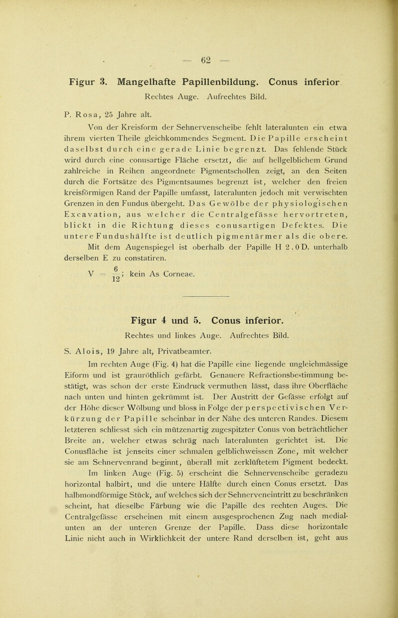 62 — Figur 3. Mangelhafte Papillenbildung. Conus inferior Rechtes Auge. Aufrechtes Bild. P. Rosa, 25 Jahre alt. Von der Kreisform der Sehnervenscheibe fehlt lateralunten ein etwa ihrem vierten Theile gleichkommendes Segment. Die Papille erscheint daselbst durch eine gerade Linie begrenzt. Das fehlende Stück wird durch eine conusartige Fläche ersetzt, die auf hellgelblichem Grund zahlreiche in Reihen angeordnete Pigmentschollen zeigt, an den Seiten durch die Fortsätze des Pigmentsaumes begrenzt ist, welcher den freien kreisförmigen Rand der Papille umfasst, lateralunten jedoch mit verwischten Grenzen in den Fundus übergeht. Das Gewölbe der physiologischen Excavation, aus welcher die Centralgefässe hervortreten, blickt in die Richtung dieses conusartigen Defektes. Die untere Fundushälfte ist deutlich pigmentärmer als die obere. Mit dem Augenspiegel ist oberhalb der Papille H 2 .0 D, unterhalb derselben E zu constatiren. V - kein As Corneae. Figur 4 und 5. Conus inferior. Rechtes und linkes Auge. Aufrechtes Bild. S. Alois, 19 Jahre alt, Privatbeamter. Im rechten Auge (Fig. 4) hat die Papille eine liegende ungleichmässige Eiform und ist grauröthlich gefärbt. Genauere Refractionsbestimmung be- stätigt, was schon der erste Eindruck vermuthen lässt, dass ihre Oberfläche nach unten und hinten gekrümmt ist. Der Austritt der Gefässe erfolgt auf der Höhe dieser Wölbung und bloss in Folge der perspecti vischen Ver- kürzung der Papille scheinbar in der Nähe des unteren Randes. Diesem letzteren schliesst sich ein mützenartig zugespitzter Conus von beträchtlicher Breite an, welcher etwas schräg nach lateralunten gerichtet ist. Die Conusfläche ist jenseits einer schmalen gelblich weissen Zone, mit welcher sie am Sehnervenrand beginnt, überall mit zerklüftetem Pigment bedeckt. Im linken Auge (Fig. 5) erscheint die Sehnervenscheibe geradezu horizontal halbirt, und die untere Hälfte durch einen Conus ersetzt. Das halbmondförmige Stück, auf welches sich der Sehnerveneintritt zu beschränken scheint, hat dieselbe Färbung wie die Papille des rechten Auges. Die Centralgefässe erscheinen mit einem ausgesprochenen Zug nach medial- unten an der unteren Grenze der Papille. Dass diese horizontale Linie nicht auch in Wirklichkeit der untere Rand derselben ist, geht aus