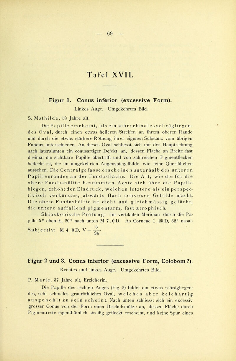 Tafel XVII. Figur 1. Conus inferior (excessive Form). Linkes Auge. Umgekehrtes Bild. S. Mathilde, 58 Jahre alt. Die Papille erscheint, als ein sehr schmales schräg liegen- des Oval, durch einen etwas helleren Streifen an ihrem oberen Rande und durch die etwas stärkere Röthung ihrer eigenen Substanz vom übrigen Fundus unterschieden. An dieses Oval schliesst sich mit der Hauptrichtung nach lateralunten ein conusartiger Defekt an, dessen Fläche an Breite fast dreimal die sichtbare Papille übertrifft und von zahlreichen Pigmentflecken bedeckt ist, die im umgekehrten Augenspiegelbilde wie feine Querfältchen aussehen. Die Centralgefässeerscheinenunterhalbdes unteren Papillenrandes an der Fundusfläche. Die Art, wie die für die obere Fundushälfte bestimmten Aeste sich über die Papille biegen, erhöht den Eindruck, welchen letztere als einperspec- tivisch verkürztes, abwärts flach convexes Gebilde macht. Die obere Fundushälfte ist dicht und gleichmässig gefärbt; die untere auffallend pigmentarm, fast atrophisch. Skiaskopische Prüfung: Im vertikalen Meridian durch die Pa- pille 5 0 oben E, 200 nach unten M 7 . 0 D. As Corneae 1 . 25 D, 320 nasal. Subjectiv: M 4 . 0 D, V = — Figur 2 und 3. Conus inferior (excessive Form, Colobom?). Rechtes und linkes Auge. Umgekehrtes Bild. P. Marie, 37 Jahre alt, Erzieherin. Die Papille des rechten Auges (Fig. 2) bildet ein etwas schrägliegen- des, sehr schmales grauröthliches Oval, welches aber kelchartig ausgehöhlt zu sein scheint. Nach unten schliesst sich ein excessiv grosser Conus von der Form einer Bischofsmütze an, dessen Fläche durch Pigmentreste eigenthümlich streifig gefleckt erscheint, und keine Spur eines