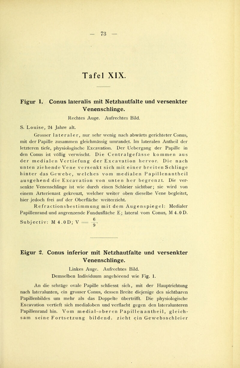 - 73 — Tafel XIX. Figur 1. Conus lateralis mit Netzhautfalte und versenkter Venenschlinge. Rechtes Auge. Aufrechtes Bild. S. Louise, 24 Jahre alt. Grosser lateraler, nur sehr wenig nach abwärts gerichteter Conus, mit der Papille zusammen gleichmässig umrandet. Im lateralen Antheil der letzteren tiefe, physiologische Excavation. Der Uebergang der Papille in den Conus ist völlig verwischt. Die Centralgefässe kommen aus der medialen Vertiefung d er Excavation hervor. Die nach unten ziehende Vene versenkt sich mit einer breiten Schlinge hinter das Gewebe, welches vom medialen P a pil len a n t heil ausgehend die Excavation von unten her begrenzt. Die ver- senkte Venenschlinge ist wie durch einen Schleier sichtbar; sie wird von einem Arterienast gekreuzt, welcher weiter oben dieselbe Vene begleitet, hier jedoch frei auf der Oberfläche weiterzieht. Refractionsbestimmung mit dem Augenspiegel: Medialer Papillenrand und angrenzende Fundusfläche E; lateral vom Conus, M4.0D. Subjectiv: M 4.OD; V = ~- Eigur 2. Conus inferior mit Netzhautfalte und versenkter Venenschlinge. Linkes Auge. Aufrechtes Bild. Demselben Individuum angehörend wie Fig. 1. An die schräge ovale Papille schliesst sich, mit der Hauptrichtung nach lateralunten, ein grosser Conus, dessen Breite diejenige des sichtbaren Papillenbildes um mehr als das Doppelte übertrifft. Die physiologische Excavation vertieft sich medialoben und verflacht gegen den lateralunteren Papillenrand hin. Vom m edia 1 -ober en Papillen anth ei 1, gleich- sam seine Fortsetzung bildend, zieht ein Gewebsschleier