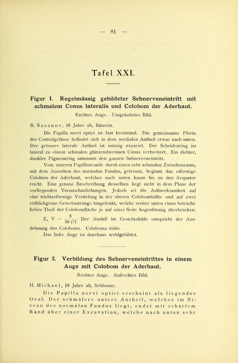 Tafel XXI. Figur 1. Regelmässig gebildeter Sehnerveneintritt mit schmalem Conus lateralis und Colobom der Aderhaut. Rechtes Auge. Umgekehrtes Bild. B. Susanne, 38 Jahre alt, Bäuerin. Die Papilla nervi optici ist fast kreisrund. Die gemeinsame Pforte der Centralgefässe befindet sich in dem medialen Antheil etwas nach unten. Der grössere laterale Antheil ist massig excavirt. Der Scheidenring ist lateral zu einem schmalen glänzendweissen Conus verbreitert. Ein dichter, dunkler Pigmentring umsäumt den ganzen Sehnerveneintritt. Vom unteren Papillenrande durch einen sehr schmalen Zwischenraum, mit dem Aussehen des normalen Fundus, getrennt, beginnt das eiförmige Colobom der Aderhaut, welches nach unten kaum bis an den Aequator reicht. Eine genaue Beschreibung desselben liegt nicht in dem Plane der vorliegenden Veranschaulichungen. Jedoch sei die Aufmerksamkeit auf eine trichterförmige Vertiefung in der oberen Colobomhälfte und auf zwei röthlichgraue Gewebsstränge hingelenkt, welche weiter unten einen beträcht- lichen Theil der Colobomfläche je auf einer Seite bogenförmig überbrücken, g E, V = — —■ Der Ausfall im Gesichtsfelde entspricht der Aus- dehnung des Coloboms. Coloboma iridis. Das linke Auge ist durchaus wohlgebildet. Figur 2. Verbildung des Sehnerveneintrittes in einem Auge mit Colobom der Aderhaut. Rechtes Auge. Aufrechtes Bild. H. Michael, 19 Jahre alt, Schlosser. Die Papilla nervi optici erscheint als liegendes Oval. Der schmälere untere Antheil, welcher im Ni- veau des normalen Fundus liegt, endet mit scharfem Rand über einer Excavation, welche nach unten sehr