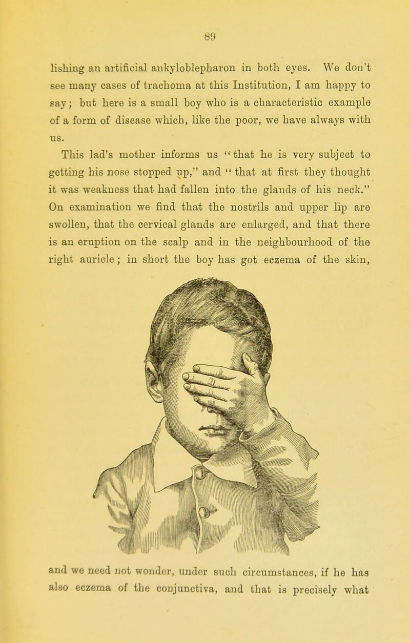 lishiug an artificial ankyloblepharon in both eyes. We don't see many cases of trachoma at this Institution, I am happy to say; but here is a small boy who is a characteristic example of a form of disease which, like the poor, we have always with us. This lad's mother informs us that he is very subject to getting his nose stopped up, and  that at first they thought it was weakness that had fallen into the glands of his neck. On examination we find that the nostrils and upper lip are swollen, that the cervical glands are enlarged, and that there is an eruption on the scalp and in the neighbourhood of the right auricle; in short the boy has got eczema of the skin, and we need not wonder, under such circumstances, if he has also eczema of the conjunctiva, and that is precisely what