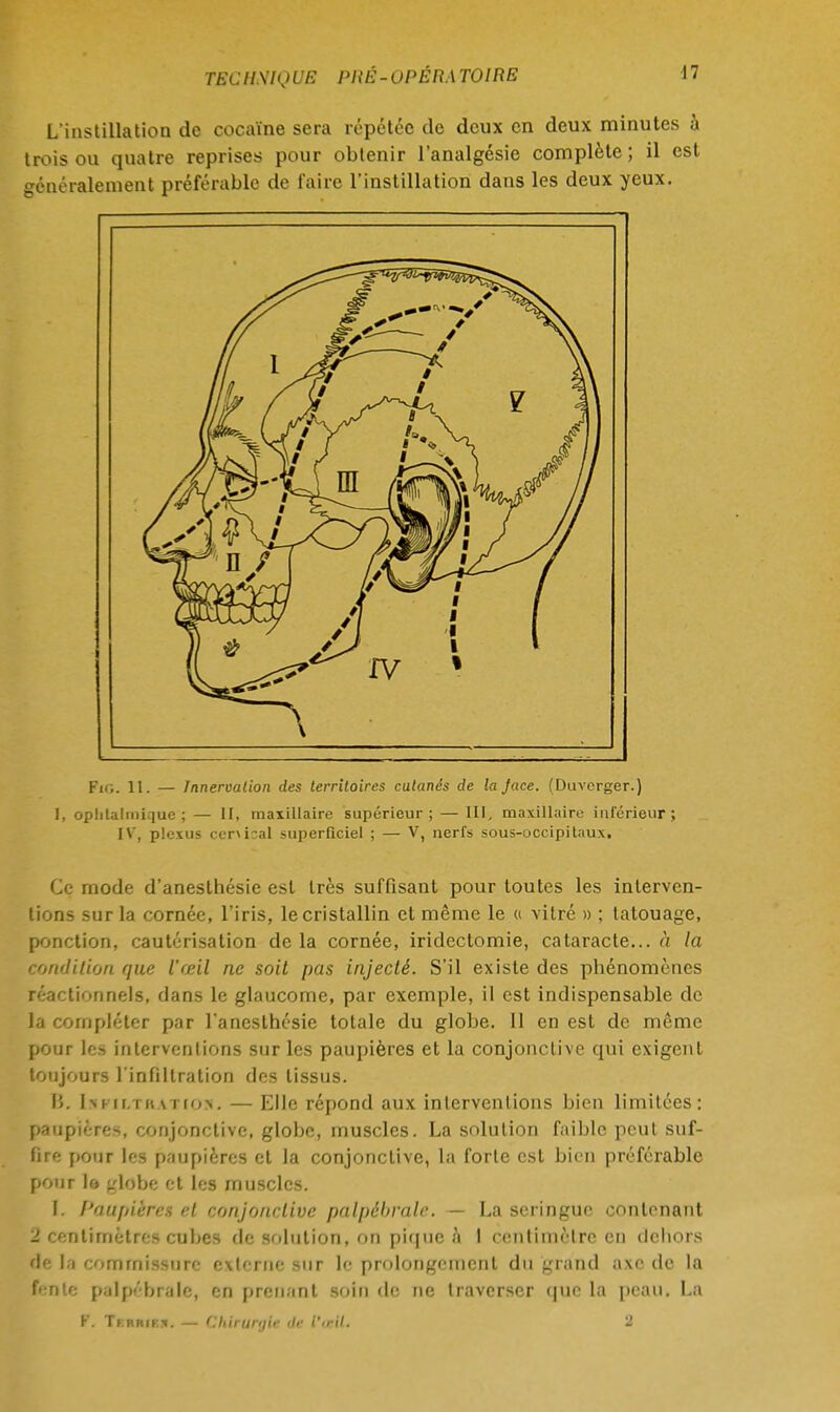 L'instillation de cocaïne sera répétée de deux en deux minutes à trois ou quatre reprises pour obtenir l'analgésie complète ; il est généralement préférable de faire l'instillation dans les deux yeux. Fio. 11. — Innervation des territoires cutanés de lajace. (Duverger.) I, ophtalmique ; — II, maxillaire supérieur; — III, maxillaire inférieur; IV, plexus cer\i:al superficiel ; — V, nerfs sous-occipitaux. Ce mode d'anesthésie est très suffisant pour toutes les interven- tions sur la cornée, l'iris, le cristallin et même le « vitré » ; tatouage, ponction, cautérisation delà cornée, iridectomie, cataracte... à la condition que l'œil ne soit pas injecté. S'il existe des phénomènes réactionnels, clans le glaucome, par exemple, il est indispensable de la compléter par l'anesthésie totale du globe. 11 en est de même pour les interventions sur les paupières et la conjonctive qui exigent toujours l'infiltration des tissus. li. I>m.TH \ rio>. — Elle répond aux interventions bien limitées: paupière-, conjonctive, globe, muscles. La solution faible peut suf- fire pour les paupières et la conjonctive, la forte est bien préférable pour la globe et les muscles. I. Paupière* et conjonctive palpébrale. — La seringue contenant 2 centimètres cubes de solution, on pique à I centimètre eD dehors de la commissure externe sur le prolongement du grand axe de la fente palpébrale, en prenant soin de ne traverser que la peau» La F. Tkbbikm. — Chirurgie de PceUt %