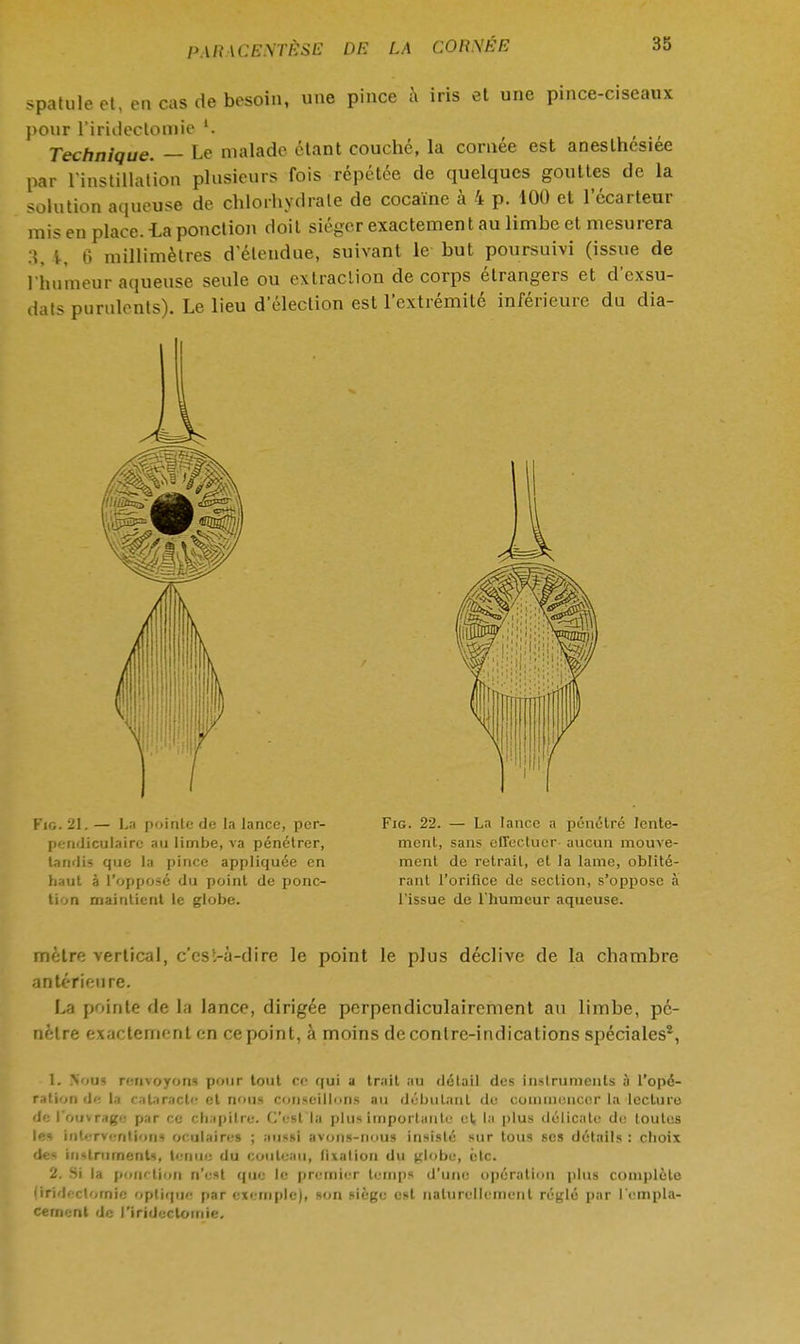 spatule et, en cas de besoin, une pince & iris et une pince-ciseaux pour l'iriilectomie Technique. — Le malade étant couché, la cornée est aneslhesiee par l'instillation plusieurs fois répétée de quelques gouttes de la solution aqueuse de chlorhydrate de cocaïne à 4 p. 100 et l'écarteur mis en place, la ponction doit siéger exactement au limbe et mesurera :!. i, 6 millimètres d'étendue, suivant le but poursuivi (issue de l'humeur aqueuse seule ou extraction de corps étrangers et d'exsu- dats purulents). Le lieu déleclion est l'extrémité inférieure du dia- Fig. 21. — La pointe de la lance, per- pendiculaire au limbe, va pénétrer, tandis que la pince appliquée en haut à l'opposé du point de ponc- tion maintient le globe. Fig. 22. — La lance a pénétré lente- ment, sans effectuer- aucun mouve- ment de retrait, et la lame, oblité- rant l'orifice de section, s'oppose à l'issue de l'humeur aqueuse. mètre vertical, c'est-à-dire le point le plus déclive de la chambre antérieure. La pointe de la lance, dirigée perpendiculairement au limbe, pé- nètre exactement en ce point, à moins de contre-indications spéciales2, 1. RoDf renvoyons pour tout ce qui a trait au détail des Instruments à l'opé- ration de la cataracte et nous conseillons au débutant de commencer la lecture de l'ouvrage par ce chapitre. C'est la plus impartante et, la plus délicate de toutes les interventions oculaires ; aussi avons-nous insisté sur tous ses détails : choix des instruments, tenue du couteau, fixation du jrlobe, èlc. 2. Si la ponction n'est que le premier temps d'une opération plus complète (irideclornic optique par exemple), son siège est naturellement réglé par l'empla- cement de l'iridectomie.