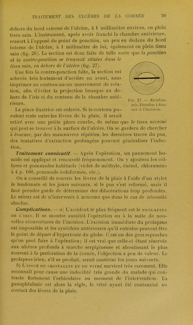 dehors du bord externe de l'ulcère, à 1 millimètre environ, en plein tissu sain. L'instrument, après avoir franchi la chambre antérieure, ressort à l'opposé du point de ponction, un peu en dedans du bord interne de l'ulcère, à l millimètre de lui, également en plein tissu sain (Tig. 20). La section est donc faite de telle sorte que la ponction et la contre-ponction se trouvent situées dans le tissu sain, en dehors de l'ulcère (fig. 27). Une fois la contre-ponction faite, la section est achevée très lentement d'arrière en avant, sans imprimer au couteau aucun mouvement de rota- tion, afin d'éviter la projection brusque au de- hors de l'iris et du contenu de la chambre anté- Fig. 27. — Kératoto- neure. mie. Etendue à don- La pince fixatrice est enlevée. Si le contenu pu- ner à l'incision, rulent reste entre les lèvres de la plaie, il serait retiré avec une petite pince courbe, de même que le tissu nécrosé qui peut se trouver à la surface de l'ulcère. On se gardera de chercher à évacuer, par des manœuvres répétées, les dernières traces du pus, des tentatives d'extraction prolongées pouvant généraliser l'infec- tion. Traitement consécutif. — Après l'opération, un pansement hu- mide est appliqué et renouvelé fréquemment. On y ajoutera les col- lyres et pommades habituels (violet de méthyle, énésol, chloramine à 4 p. 100, pommade iodoformée, etc.). On a conseillé de rouvrir les lèvres de la plaie à l'aide d'un stylet le lendemain et les jours suivants, si le pus s'est reformé, mais il faut prendre garde de déterminer des dilacéralions trop profondes. Le mieux est de n'intervenir à nouveau que dans le cas de nécessité absolue. Complications. — a) L'accident le plus fréquent est le pkolapsus de l'iris. Il se montre aussitôt l'opération ou à la suite de nou- velles réouvertures de l'incision. L'excision immédiate du prolapsus est impossible et les synéchies antérieures qu'il entraîne peuvent être le point de départ d'hyperlonie du globe. C'est un des gros reproches qu'on peut faire à l'opération; il est vrai que celle-ci étant réservée aux ulcères profonds à marche serpigineuse et aboutissant le plus souvent à la perforation de la cornée, l'objection a peu de valeur. Le prolapsus irien, s'il se produit, serait cautérisé les jours suivants. b) L'issi.e nu cristalm> et nu virnic survient très rarement. Elle reconnaît pour cause une indocilité très grande du malade qui con- tracte fortement l'orbiculairc au moment de l'intervention. La panophlalmie est alors la règle, le vitré ayant été contaminé au contact des lèvres de la plaie.