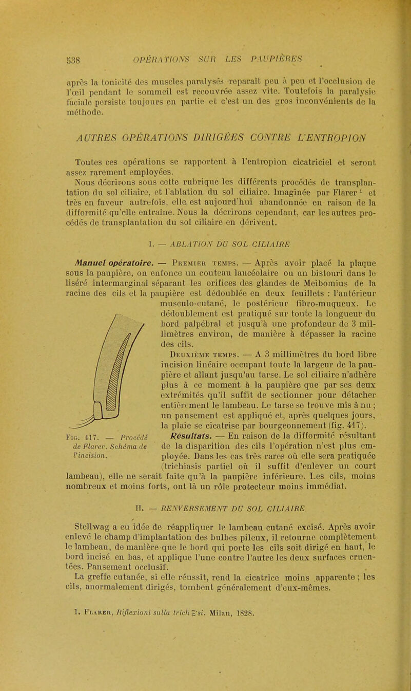 après la tonicité des muscles paralysés réparai! peu à peu et l'occlusion du l'œil pendant le sommeil est recouvrée assez, vite. Toutefois la paralysie faciale persiste toujours en partie et c'est un des gros inconvénients de la mél liodc. AUTRES OPÉRATIONS DIRIGÉES CONTRE L'ENTROPION Toutes ces opérations se rapportent à l'entropion cicatriciel et seront assez rarement employées. Nous décrirons sous cette rubrique les différents procédés de transplan- tation du sol ciliaire, et l'ablation du sol ciliaire. Imaginée par Flarer1 et très en faveur autrefois, elle est aujourd'hui abandonnée en raisou de la difformité qu'elle entraîne. Nous la décrirons cependant, car les autres pro- cédés de transplantation du sol ciliaire en dérivent. I. — ABLATION DU SOL CILIAIRE Manuel opératoire. — Puemirr temps. —Après avoir placé la plaque sous la paupière, on enfonce un couteau lancéolaire on un bistouri dans le liséré intermarginal séparant les orifices des glandes de Mcibomius de la racine des cils et la paupière est dédoublée en deux feuillets : l'antérieur musculo-cutané, le postérieur fibro-muqueux. Le dédoublement est pratiqué sur toute la longueur du bord palpébral et jusqu'à une profondeur de 3 mil- limètres environ, de manière à dépasser la racine des cils. Deuxième temps. — A3 millimètres du bord libre incision linéaire occupant toute la largeur de la pau- pière et allant jusqu'au tarse. Le sol ciliaire n'adhère plus à ce moment à la paupière que par ses deux extrémités qu'il suffit de sectionner pour détacher entièrement le lambeau. Le tarse se trouve mis à nu ; un pansement est appliqué et, après quelques jours, la plaie se cicatrise par bourgeonnement (fig. 417). l'io. 4i7. Procédé Résultats. — En raison de la difformité résultant de Flurer. Schéma de de la disparition des cils l'opération n'est plus em- l'incision. ployée. Dans les cas très rares où elle sera pratiquée (trichiasis partiel où il suffit d'enlever un court lambeau), elle ne serait faite qu'à la paupière inférieure. Les cils, moins nombreux et moins forts, ont là un rôle protecteur moins immédiat. II. — RENVERSEMENT DU SOL CILIAIRE Stellwag a eu idée de réappliquer le lambeau cutané excisé. Après avoir enlevé le champ d'implantation des bulbes pileux, il retourne complètement le lambeau, de manière que le bord qui porte les cils soit dirigé en haut, le bord incisé en bas, et applique l'une contre l'autre les deux surfaces rruen- tées. Pansement occlusif. La greffe cutanée, si elle réussit, rend la cicatrice moins apparente ; les cils, anormalement dirigés, tombent généralement d'eux-mêmes. 1. Flarer, Riflexioni sulla trichZ'si. Milan, 1828.