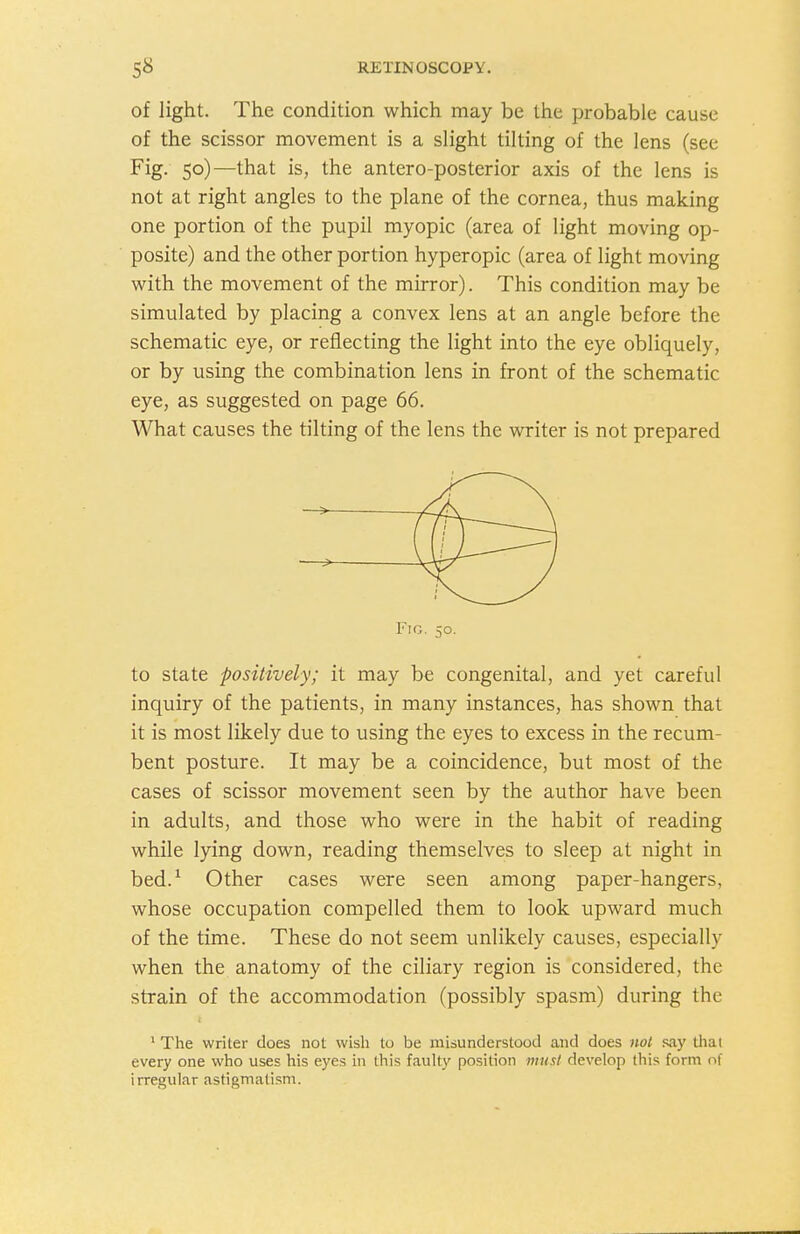 of light. The condition which may be the probable cause of the scissor movement is a slight tilting of the lens (see Fig. 50)—that is, the antero-posterior axis of the lens is not at right angles to the plane of the cornea, thus making one portion of the pupil myopic (area of light moving op- posite) and the other portion hyperopic (area of light moving with the movement of the mirror). This condition may be simulated by placing a convex lens at an angle before the schematic eye, or reflecting the light into the eye obliquely, or by using the combination lens in front of the schematic eye, as suggested on page 66. What causes the tilting of the lens the writer is not prepared Fig. 50. to state positively; it may be congenital, and yet careful inquiry of the patients, in many instances, has shown that it is most likely due to using the eyes to excess in the recum- bent posture. It may be a coincidence, but most of the cases of scissor movement seen by the author have been in adults, and those who were in the habit of reading while lying down, reading themselves to sleep at night in bed.^ Other cases were seen among paper-hangers, whose occupation compelled them to look upward much of the time. These do not seem unlikely causes, especially when the anatomy of the ciliary region is considered, the strain of the accommodation (possibly spasm) during the ^ The writer does not wish to be misunderstood and does not say tliai every one who uses his eyes in this faulty position must develop this form of irregular astigmatism.