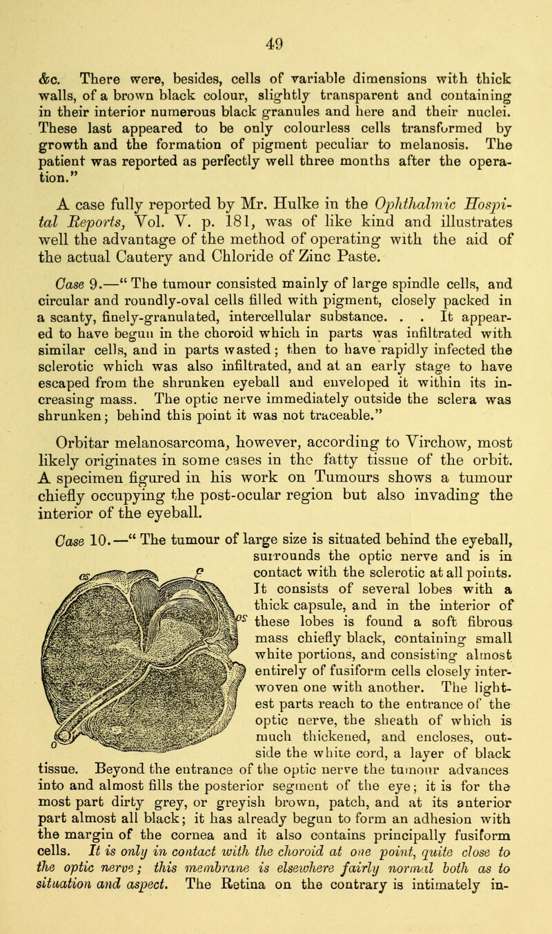 &c. There were, besides, cells of variable dimensions with thick walls, of a brown black colour, slightly transparent and containing in their interior numerous black granules and here and their nuclei. These last appeared to be only colourless cells transformed by growth and the formation of pigment peculiar to melanosis. The patient was reported as perfectly well three months after the opera- tion. A case fully reported by Mr. Hulke in the OjjJithalmic Hosjn- tal Beports, Vol. Y. p. 181, was of like kind and illustrates well the advantage of the method of operating with the aid of the actual Cautery and Chloride of Zinc Paste. Case 9.—The tumour consisted mainly of large spindle cells, and circular and roundly-oval cells filled with pigment, closely packed in a scanty, finely-granulated, intercellular substance. . . It appear- ed to have begun in the choroid which in parts was infiltrated with similar cells, and in parts wasted; then to have rapidly infected the sclerotic which was also infiltrated, and at an early stage to have escaped from the shrunken eyeball and enveloped it within its in- creasing mass. The optic nerve immediately outside the sclera was shrunken; behind this point it was not traceable. Orbitar melanosarcoma, however, according to Virchow, most likely originates in some cases in the fatty tissue of the orbit. A specimen figured in his work on Tumours shows a tumour chiefly occupying the post-ocular region but also invading the interior of the eyeball. Case 10.— The tumour of large size is situated behind the eyeball, surrounds the optic nerve and is in contact with the sclerotic at all points. It consists of several lobes with a thick capsule, and in the interior of these lobes is found a soft fibrous mass chiefly black, containing small white portions, and consisting almost entirely of fusiform cells closely inter- woven one with another. The light- est parts reach to the entrance of the optic nerve, the sheath of which is much thickened, and encloses, out- side the white cord, a layer of black tissue. Beyond the entrance of the optic nerve the tumour advances into and almost fills the posterior segment of the eye; it is for the most part dirty grey, or greyish brown, patch, and at its anterior part almost all black; it has already begun to form an adhesion with the margin of the cornea and it also contains principally fusiform cells. It is only in contact ivith the choroid at one point, quite close to the optic nerve; this membrane is elsewhere fairly normal both as to situation and aspect. The Retina on the contrary is intimately in-