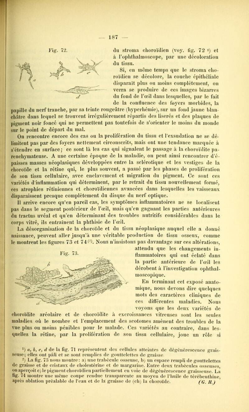 V'ig. 72. du stroRKi clioroïclien (voy. fi^. 72 >) et à l'oplitlialmoscopo, par uiKi décoloratioii f'^^A ^ niemc temps (juc stroma clio- I roïdicii se décolore, la couche (''j)i(liéliale disparaît plus ou moins complètement, ou verra se produire de ces images bizarres du fond de l'œil dans les([uelles, par le fait de la confluence des foyers morbides, la papille du nerf tranche, par sa teinte rougeatre (hyperhémie), sur un fond jaune blan- châtre dans lequel se trouvent irrégulièrement répartis des liserés et des placiues de pigment noir foncé qui ne permettent pas toutefois de s'orienter le moins du monde sur le point de départ du mal. On rencontre encore des cas ou la prolifération du tissu et l'exsudation ne se dé- limitent pas par des foyers nettement circonscrits, mais ont une tendance marquée à s'étendre en surface; ce sont là les cas qui signalent le passage à la choroïdite pa- renchymateuse. A une certaine époque de la maladie, on peut ainsi rencontrer d'é- paisses masses néoplasiques développées entre la sclérotique et les vestiges de la choroïde et la rétine qui, le plus souvent, a passé par les phases de prolifération de son tissu cellulaire, avec enclavement et migration du pigment. Ce sont ces variétés d'inflammation qui déterminent, par le retrait du tissu nouvellement formé, ces atrophies rétiniennes et choroïdiennes avancées dans lesquelles les vaisseaux disparaissent presque complètement du disque du nerf optique. Il arrive encore qu'en pareil cas, les symptômes inflammatoires ne se localisent pas dans le segment postérieur de l'œil, mais qu'en gagnant les parties antérieures du tractus uvéal et qu'en déterminant des troubles nutritifs considérables dans le corps vitré, ils entraînent la plithisie de l'œil. La désorganisation de la choroïde et du tissu néoplasique auquel elle a donné naissance, peuvent aller jusqu'à une véritable production de tissu osseux, comme le montrent les figures 73 et 74(-). Nous n'insistons pas davantage sur ces altérations, attendu que les changements in- ^^o- 73. flammatoires qui ont éclaté dans ^ , ^^^^^^^ b^ partie antérieure de l'œil les ) ^^^wï^'?'' dérobent à l'investigation ophthal- V 3> '. - -V moscopique. ^ V En terminant cet exposé anato- ' mique, nous devons dire quelques mots des caractères cliniques de ces différentes maladies. Nous voyons que les deux variétés de choroïdite aréolaire et de choroïdite à excroissances vitreuses sont les seules maladies où le nombre et l'emplacement des scotomes amènent des troubles de la vue plus ou moins pénibles pour le malade. Ces variétés au contraire, dans les- quelles la rétine, par la prolifération de son tissu cellulaire, joue un rôle si ^) a, h, c, d de la fig. 71 représentent des cellules atteintes de dégénérescence grais- seuse; elles ont pfili et se sont remplies de gouttelettes de graisse -) La fig. 73 nous montre: a) une trabécule osseuse, b; nu espace rempli de gouttelettes de graisse et de cristaux de cholestérine et de margarine. Entre deux trabécules osseuses, ou aperçoit c) le pigment choroïdien partiellement envoie de dégénérescence graisseuse. La fig. 74 montre une même coupe rendue transparente au moyeu de l'huile de térébenthine, après ablation préalable de l'eau et de la graisse de (ch) la choroïde. (G. H.j