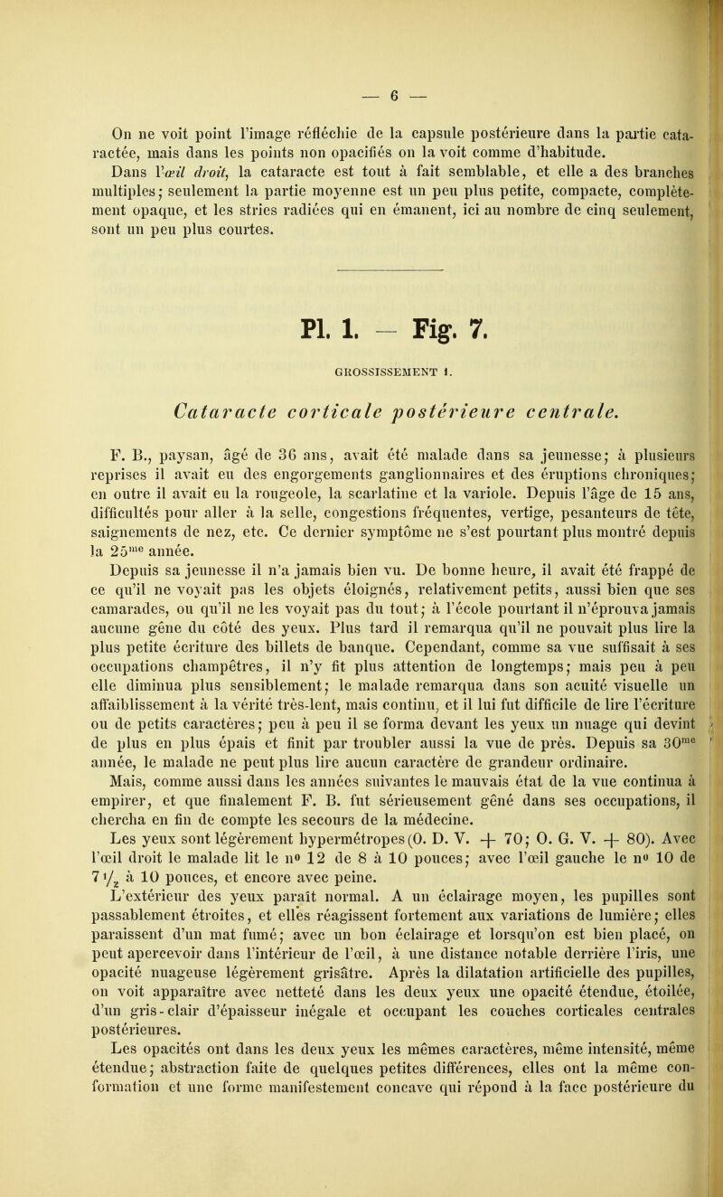 On ne voit point l'image réfléchie de la capsule postérieure clans la partie cata- ractée, mais dans les points non opacifiés on la voit comme d'habitude. Dans Vœïl droit, la cataracte est tout à fait semblable, et elle a des branches multiples ; seulement la partie moyenne est un peu plus petite, compacte, complète- ment opaque, et les stries radiées qui en émanent, ici au nombre de cinq seulement, sont un peu plus courtes. Pl. 1. - Fig. 7. GROSSISSEMENT 1. Cataracte corticale postérieure centrale, F. B., paysan, âgé de 36 ans, avait été malade dans sa jeunesse,* à plusieurs reprises il avait eu des engorgements ganglionnaires et des éruptions chroniques; en outre il avait eu la rougeole, la scarlatine et la variole. Depuis l'âge de 15 ans, difficultés pour aller à la selle, congestions fréquentes, vertige, pesanteurs de tête, saignements de nez, etc. Ce dernier symptôme ne s'est pourtant plus montré depuis la 25'*^ année. Depuis sa jeunesse il n'a jamais bien vu. De bonne heure, il avait été frappé de ce qu'il ne voyait pas les objets éloignés, relativement petits, aussi bien que ses camarades, ou qu'il ne les voyait pas du tout,- à l'école pourtant il n'éprouva jamais aucune gene du côté des yeux. Plus tard il remarqua qu'il ne pouvait plus lire la plus petite écriture des billets de banque. Cependant, comme sa vue suffisait à ses occupations champêtres, il n'y fit plus attention de longtemps; mais peu à peu elle diminua plus sensiblement; le malade remarqua dans son acuité visuelle un affaiblissement à la vérité très-lent, mais continu^ et il lui fut difficile de lire l'écriture ou de petits caractères; peu à peu il se forma devant les yeux un nuage qui devint de plus en plus épais et finit par troubler aussi la vue de près. Depuis sa 30^*^ année, le malade ne peut plus lire aucun caractère de grandeur ordinaire. Mais, comme aussi dans les années suivantes le mauvais état de la vue continua à empirer, et que finalement F. B. fut sérieusement gêné dans ses occupations, il chercha en fin de compte les secours de la médecine. Les yeux sont légèrement hypermétropes (0. D. V. -|- 70; 0. G. V. -)- 80). Avec l'œil droit le malade lit le n» 12 de 8 à 10 pouces; avec l'œil gauche le n 10 de Ti/j, à 10 pouces, et encore avec peine. L'extérieur des yeux paraît normal. A un éclairage moyen, les pupilles sont passablement étroites, et elles réagissent fortement aux variations de lumière; elles paraissent d'un mat fumé; avec un bon éclairage et lorsqu'on est bien placé, on peut apercevoir dans l'intérieur de l'œil, à une distance notable derrière l'iris, une opacité nuageuse légèrement grisâtre. Après la dilatation artificielle des pupilles, on voit apparaître avec netteté dans les deux yeux une opacité étendue, étoilée, d'un gris-clair d'épaisseur inégale et occupant les couches corticales centrales postérieures. Les opacités ont dans les deux yeux les mêmes caractères, même intensité, même étendue; abstraction faite de quelques petites différences, elles ont la même con- formation et une forme manifestement concave qui répond à la face postérieure du