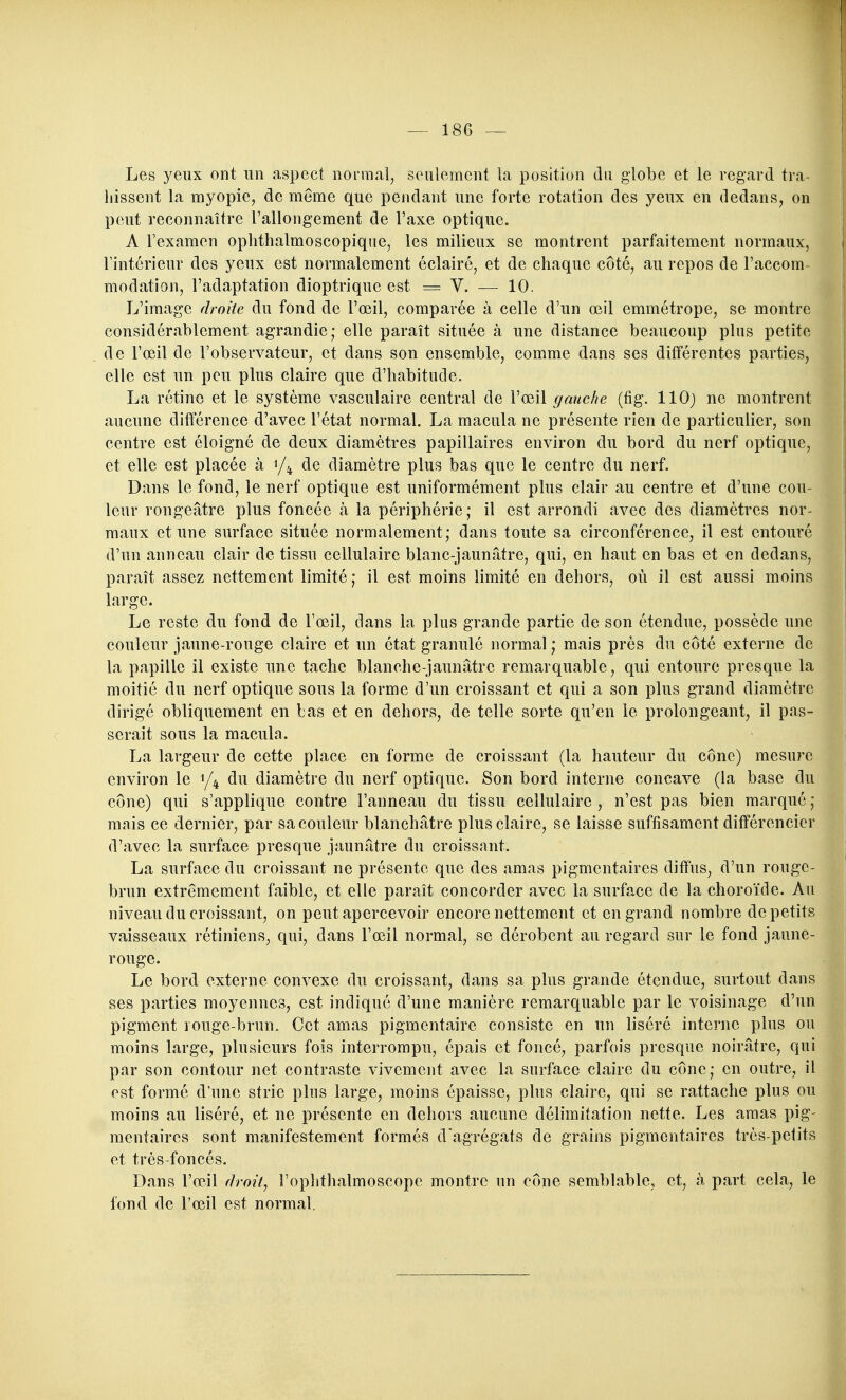 Les yeux ont un aspect normal, seulement la position du globe et le regard tra- hissent la myopie, de même que pendant une forte rotation des yeux en dedans, on peut reconnaître rallongement de Taxe optique. A l'examen ophthalmoscopique, les milieux se montrent parfaitement normaux, l'intérieur des yeux est normalement éclairé, et de chaque côté, au repos de l'accom modation, l'adaptation dioptrique est = V. — 10, L'image droite du fond de l'œil, comparée à celle d'un œil emmétrope, se montre considérablement agrandie; elle paraît située à une distance beaucoup plus petite de l'œil de l'observateur, et dans son ensemble, comme dans ses différentes parties, elle est un peu plus claire que d'habitude. La rétine et le système vasculaire central de l'œil gauche (fig. 110) ne montrent aucune différence d'avec l'état normal. La macula ne présente rien de particulier, son centre est éloigné de deux diamètres papillaires environ du bord du nerf optique, et elle est placée à 1/4 de diamètre plus bas que le centre du nerf. Dans le fond, le nerf optique est uniformément plus clair au centre et d'une cou- leur rongeâtre plus foncée à la périphérie; il est arrondi avec des diamètres nor- maux et une surface située normalement; dans toute sa circonférence, il est entouré d'un anneau clair de tissu cellulaire blanc-jaunâtre, qui, en haut en bas et en dedans, paraît assez nettement limité; il est moins limité en dehors, où il est aussi moins large. Le reste du fond de l'œil, dans la plus grande partie de son étendue, possède une couleur jaune-rouge claire et un état granulé normal ; mais près du côté externe de la papille il existe une tache blanche-jaunâtre remarquable, qui entoure presque la moitié du nerf optique sous la forme d'un croissant et qui a son plus grand diamètre dirigé obliquement en bas et en dehors, de telle sorte qu'en le prolongeant, il pas- serait sous la macula. La largeur de cette place en forme de croissant (la hauteur du cône) mesure environ le 1/4 du diamètre du nerf optique. Son bord interne concave (la base du cône) qui s'applique contre l'anneau du tissu cellulaire, n'est pas bien marqué; mais ce dernier, par sa couleur blanchâtre plus claire, se laisse suffisament différencier d'avec la surface presque jaunâtre du croissant. La surface du croissant ne présente que des amas pigmentaires diffus, d'un rouge- brun extrêmement faible, et elle paraît concorder avec la surface de la choroïde. Au niveau du croissant, on peut apercevoir encore nettement et en grand nombre de petits vaisseaux rétiniens, qui, dans l'œil normal, se dérobent au regard sur le fond jaune- rouge. Le bord externe convexe du croissant, dans sa plus grande étendue, surtout dans ses parties moyennes, est indiqué d'une manière remarquable par le voisinage d'un pigment rouge-brun. Cet amas pigmentaire consiste en un liséré interne plus ou moins large, plusieurs fois interrompu, épais et foncé, parfois presque noirâtre, qui par son contour net contraste vivement avec la surface claire du cône; en outre, il est formé d'une strie plus large, moins épaisse, plus claire, qui se rattache plus ou moins au liséré, et ne présente en dehors aucune délimitation nette. Les amas pig- mentaires sont manifestement formés d'agrégats de grains pigmentaires très-petit et très-foncés. Dans l'œil flmit, l'ophthalmoscope montre un cône semblable, et, à part cela, le fond de l'œil est normal.