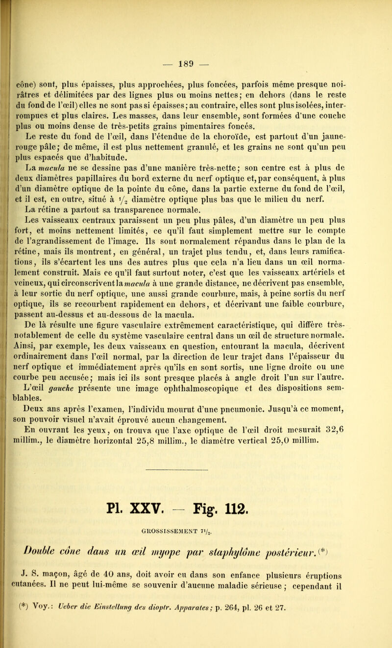 cône) sont, plus épaisses, plus approchées, plus foncées, parfois même presque noi- râtres et délimitées par des lignes plus ou moins nettes; en dehors (dans le reste du fond de l'œil) elles ne sont pas si épaisses; au contraire, elles sont plus isolées, inter- rompues et plus claires. Les masses, dans leur ensemble, sont formées d'une couche plus ou moins dense de très-petits grains pimentaires foncés. Le reste du fond de l'œil, dans l'étendue de la choroïde, est partout d'un jaune- rouge pâle; de même, il est plus nettement granulé, et les grains ne sont qu'un peu plus espacés que d'habitude. Ij2i macula ne se dessine pas d'une manière très-nette; son centre est à plus de deux diamètres papillaires du bord externe du nerf optique et, par conséquent, à plus d'un diamètre optique de la pointe du cône, dans la partie externe du fond de l'œil, et il est, en outre, situé à 1/3 diamètre optique plus bas que le milieu du nerf. La rétine a partout sa transparence normale. Les vaisseaux centraux paraissent un peu plus pâles, d'un diamètre un peu plus fort, et moins nettement limités, ce qu'il faut simplement mettre sur le compte de l'agrandissement de l'image. Ils sont normalement répandus dans le plan de la rétine, mais ils montrent, en général, un trajet plus tendu, et, dans leurs ramifica- tions, ils s'écartent les uns des autres plus que cela n'a lieu dans un œil norma- lement construit. Mais ce qu'il faut surtout noter, c'est que les vaisseaux artériels et veineux, qui circonscrivent la aune grande distance, ne décrivent pas ensemble, à leur sortie du nerf optique, une aussi grande courbure, mais, à peine sortis du nerf optique, ils se recourbent rapidement en dehors, et décrivant une faible courbure, passent au-dessus et au-dessous de la macula. De là résulte une figure vasculaire extrêmement caractéristique, qui diffère très- notablement de celle du système vasculaire central dans un œil de structure normale. Ainsi, par exemple, les deux vaisseaux en question, entourant la macula, décrivent ordinairement dans l'œil normal, par la direction de leur trajet dans l'épaisseur du nerf optique et immédiatement après qu'ils en sont sortis, une ligne droite ou une courbe peu accusée ; mais ici ils sont presque placés à angle droit l'un sur l'autre. L'œil gauche présente une image ophthalmoscopique et des dispositions sem- blables. Deux ans après l'examen, l'individu mourut d'une pneumonie. Jusqu'à ce moment, son pouvoir visuel n'avait éprouvé aucun changement. En ouvrant les yeux, on trouva que l'axe optique de l'œil droit mesurait 32,6 millim., le diamètre horizontal 25,8 millim., le diamètre vertical 25,0 millim. Pl. XXV. - Fig. 112. GROSSISSEMENT 71/2. Double cdne dans un œil myope par- staphylôrne postérieurs^) J. S. maçon, âgé de 40 ans, doit avoir eu dans son enfance plusieurs éruptions cutanées. Il ne peut lui-même se souvenir d'aucune maladie sérieuse ; cependant il (*) Voy.: Ucber die Einstdlmig des dioplr. Apparûtes; p. 264, pl. 26 et 27.