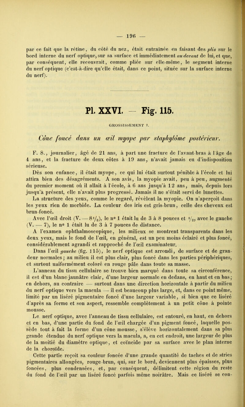 par ce fait que la rétine, du côté du nez, était entraînée en faisant des plis sur le bord interne du nerf optique, sur sa surface et immédiatement au devant de lui, et que, par conséquent, elle recouvrait, comme pliée sur elle-même, le segment interne du nerf optique (c'est-à-dire qu'elle était, dans ce point, située sur la surface interne du nerf). Pl. XXVI. - Fig. 115. GROSSISSEMENT 7. Cône foncé dans un œil myope par staphylôme postérieur. F. S., journalier, âgé de 21 ans, à part une fracture de l'avant-bras à lâge de 4 ans, et la fracture de deux côtes à 19 ans, n'avait jamais eu d'indisposition sérieuse. Dès son enfance, il était myope, ce qui lui était surtout pénible à l'école et lui attira bien des désagréments. A son avis, la myopie avait, peu à peu, augmenté du premier moment où il allait à l'école, à 6 ans jusqu'à 12 ans, mais, depuis lors jusqu'à présent, elle n'avait plus progressé. Jamais il ne s'était servi de lunettes. La structure des yeux, comme le regard, révèlent la myopie. On n'aperçoit dans les yeux rien de morbide. La couleur des iris est gris-brun, celle des cheveux est brun-foncé. Avec l'œil droit (V. —^S^/o), le no 1 était lu de 3 à 8 pouces et «/g, avec le gauche (V. — 7), le n» 1 était lu de 3 à 7 pouces de distance. A l'examen ophthalmoscopique, les milieux se montrent transparents dans les deux yeux, mais le fond de l'œil, en général, est un peu moins éclairé et plus foncé, considérablement agrandi et rapproché de l'œil examinateur. Dans l'œil gauche (fig. 115), le nerf optique est arrondi, de surface et de gran- deur normales ; au milieu il est plus clair, plus foncé dans les parties périphériques, et surtout uniformément coloré en rouge pâle dans toute sa masse. L'anneau du tissu cellulaire se trouve bien marqué dans toute sa circonférence, il est d'un blanc jaunâtre clair, d'une largeur normale en dedans, en haut et en bas; en dehors, au contraire — surtout dans une direction horizontale à partir du milieu du nerf optique vers la macula — il est beaucoup plus large, et, dans ce point même, limité par un liséré pigmentaire foncé d'une largeur variable, si bien que ce liséré d'après sa forme et son aspect, ressemble complètement à un petit cône à pointe mousse. Le nerf optique, avec l'anneau de tissu cellulaire, est entouré, en haut, en dehors et en bas, d'une partie du fond de l'œil chargée d'un pigment foncé, laquelle pos- sède tout à fait la forme d'un cône mousse, s'élève horizontalement dans sa plus grande étendue du nerf optique vers la macula, a, en cet endroit, une largeur de plus de la moitié du diamètre optique, et coïncide par sa surface avec le plan interne de la choroïde. Cette partie reçoit sa couleur foncée d'une grande quantité de taches et de stries pigmentaires allongées, rouge-brun, qui, sur le bord, deviennent plus épaisses, plus foncées, plus condensées, et, par conséquent, délimitent cette région du reste du fond de l'œil par un liséré foncé parfois même noirâtre. Mais ce liséré se con-