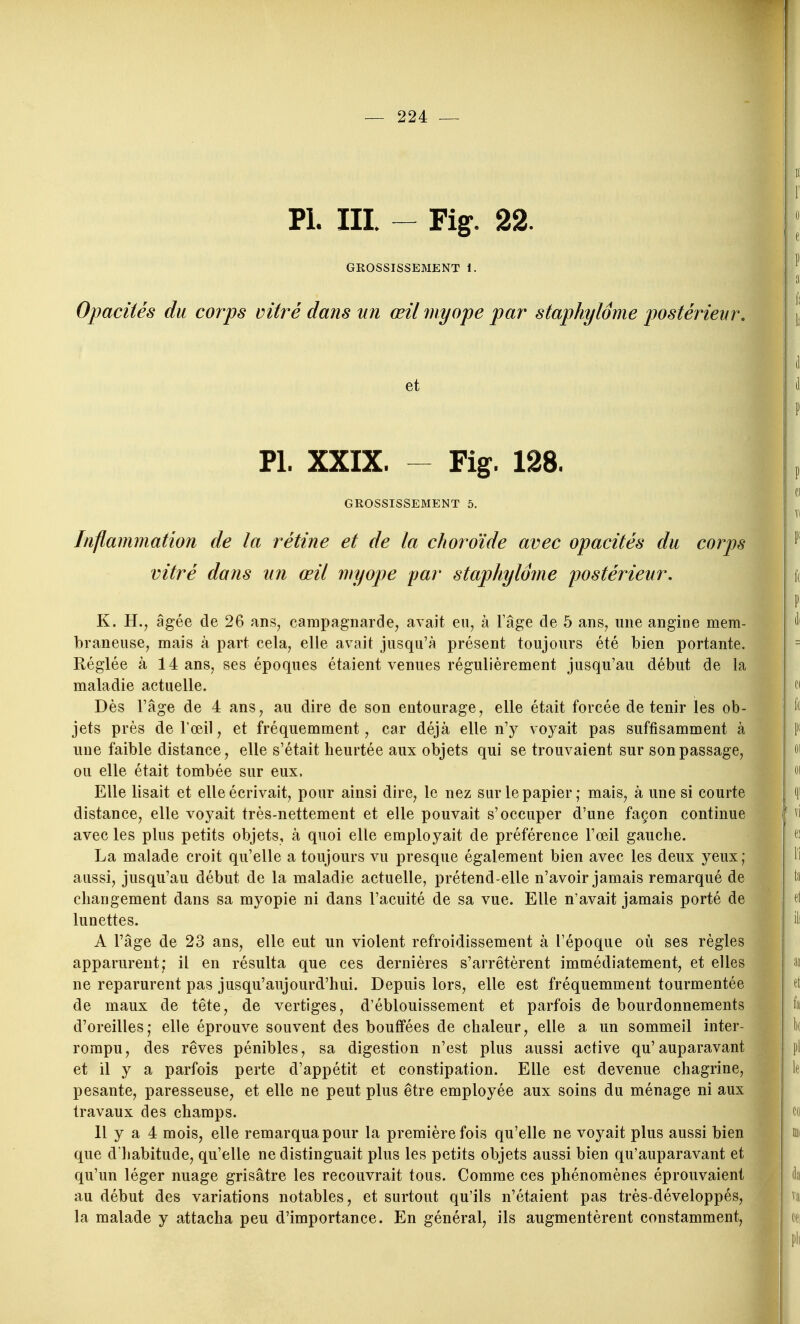 Pl. III. - Fig. 22. GROSSISSEMENT i. Opacités du corps vitré dans un œil 7nyope par staphylome postérieur. et Pl. XXIX. - Fig. 128. GROSSISSEMENT 5. Inflammation de la rétine et de la choroïde avec opacités du corps vitré dans un œil myope par staphyloîne postérieur. K. H.j âgée de 26 ans, campagnarde, avait eu, à l'âge de 5 ans, une angine mem- braneuse, mais à part cela, elle avait jusqu'à présent toujours été bien portante. Réglée à 14 ans, ses époques étaient venues régulièrement jusqu'au début de la maladie actuelle. Dès l'âge de 4 ans, au dire de son entourage, elle était forcée détenir les ob- jets près de l'œil, et fréquemment, car déjà elle n'y voyait pas suffisamment à une faible distance, elle s'était heurtée aux objets qui se trouvaient sur son passage, ou elle était tombée sur eux. Elle lisait et elle écrivait, pour ainsi dire, le nez sur le papier; mais, à une si courte distance, elle voyait très-nettement et elle pouvait s'occuper d'une façon continue avec les plus petits objets, à quoi elle employait de préférence l'œil gauche. La malade croit qu'elle a toujours vu presque également bien avec les deux yeux; aussi, jusqu'au début de la maladie actuelle, prétend-elle n'avoir jamais remarqué de changement dans sa myopie ni dans l'acuité de sa vue. Elle n'avait jamais porté de lunettes. A l'âge de 23 ans, elle eut un violent refroidissement à l'époque où ses règles apparurent; il en résulta que ces dernières s'arrêtèrent immédiatement, et elles ne reparurent pas jusqu'aujourd'hui. Depuis lors, elle est fréquemment tourmentée de maux de tête, de vertiges, d'éblouissement et parfois de bourdonnements d'oreilles; elle éprouve souvent des bouffées de chaleur, elle a un sommeil inter- rompu, des rêves pénibles, sa digestion n'est plus aussi active qu'auparavant et il y a parfois perte d'appétit et constipation. Elle est devenue chagrine, pesante, paresseuse, et elle ne peut plus être employée aux soins du ménage ni aux travaux des champs. Il y a 4 mois, elle remarqua pour la première fois qu'elle ne voyait plus aussi bien que d habitude, qu'elle ne distinguait plus les petits objets aussi bien qu'auparavant et qu'un léger nuage grisâtre les recouvrait tous. Comme ces phénomènes éprouvaient au début des variations notables, et surtout qu'ils n'étaient pas très-développés, la malade y attacha peu d'importance. En général, ils augmentèrent constamment,