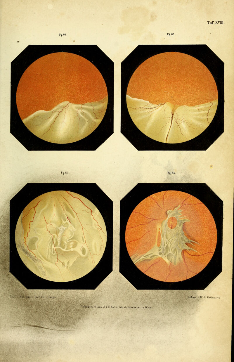 Ji 82 . Ta£Xm •flfa^lriick ;ius ù k k !iof' a SUaUflruckt-rci ni VV'^en