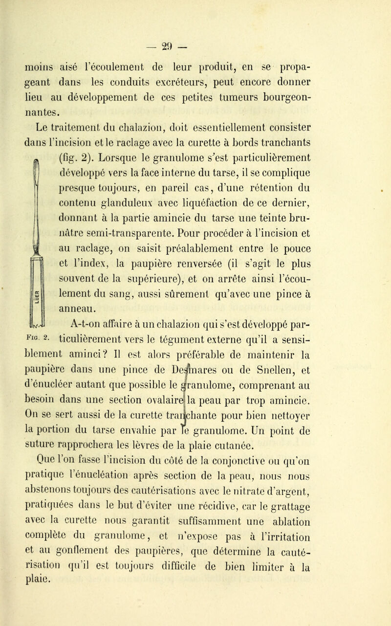 moins aisé récoulement de leur produit, en se propa- geant dans les conduits excréteurs, peut encore donner lieu au développement de ces petites tumeurs bourgeon- nantes. Le traitement du chalazion, doit essentiellement consister dans l'incision et le raclage avec la curette à bords tranchants |, (fig. 2). Lorsque le granulome s'est particulièrement développé vers la face interne du tarse, il se complique presque toujours, en pareil cas, d'une rétention du contenu glanduleux avec liquéfaction de ce dernier, donnant à la partie amincie du tarse une teinte bru- ^ nâtre semi-transparente. Pour procéder à l'incision et Il au raclage, on saisit préalablement entre le pouce et l'index, la paupière renversée (il s'agit le plus souvent de la supérieure), et on arrête ainsi l'écou- lement du sang, aussi sûrement qu'avec une pince à ![ anneau. wJ A-t-on affaire à un chalazion qui s'est développé par- 2. ticulièrement vers le tégument externe qu'il a sensi- blement aminci? Il est alors préférable de maintenir la paupière dans une pince de De|!TQares ou de Snellen, et d'énucléer autant que possible le granulome, comprenant au besoin dans une section ovalairella peau par trop amincie. On se sert aussi de la curette traiichante pour bien nettoyer la portion du tarse envahie par Te granulome. Un point de suture rapprochera les lèvres de la plaie cutanée. Que l'on fasse l'incision du côté de la conjonctive ou qu'on pratique l'énucléation après section de la peau, nous nous abstenons toujours des cautérisations avec le nitrate d'argent, pratiquées dans le but d'éviter une récidive, car le grattage avec la curette nous garantit suffisamment une ablation complète du granulome, et n'expose pas à l'irritation et au gonflement des paupières, que détermine la cauté- risation qu'il est toujours difficile de bien limiter à la plaie.