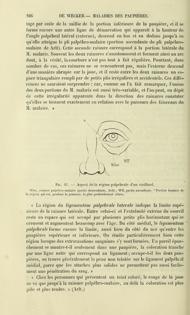 tage par suite de la saillie de la portion inférieure de la paupière, et il se forme encore une autre ligne de démarcation qui apparaît à la hauteur de Fangle palpébral latéral (externe), descend en bas et en dedans jusqu'à ce qu'elle atteigne le pli palpébro-malaire (portion ascendante du pli palpébro- malaire de Arlt). Cette seconde rainure correspond à la portion latérale du M. malaris. Souvent les deux rainures s'anastomosent et forment ainsi un arc dont, à la vérité, la courbure n'est pas tout à fait régulière. Pourtant, dans nombre de cas, ces rainures ne se rencontrent pas, mais l'externe descend d'une manière abrupte sur la joue, et il reste entre les deux rainures un es- pace triangulaire rempli par de petits plis irréguliers et accidentels. Ces diffé- rences ne sauraient surprendre : car, comme on l'a fait remarquer, Tunion des deux portions du M. malaris est aussi très-variable, et l'on peut, en dépit de cette irrégularité apparente dans la direction des rainures constater qu'elles se tiennent exactement en relation avec le parcours des faisceaux du M. malaire. » FiG. il. — Aspect delà région palpébrale d'un vieillard. Wliiî, rainure palpebro-maiaire (partie descendante, Ai'lt) ; Wll, partie ascendante. * Portion bombo'c de la région qui est, pendant la jeunesse, la plus profondément située. (( La région du ligamentuni palpébrale latérale indique la limite supé- rieure de la rainure latérale. Entre celui-ci et l'extrémité externe du sourcil reste un espace qui est occupé par plusieurs petits plis horizontaux qui se creusent et augmentent beaucoup avec l'âge. Du côté médiat, le Ugamentum * palpébrale forme encore la limite, aussi bien du côté du nez qu'entre les paupières supérieure et inférieure. On étudie particulièrement bien cette région lorsque des extravasations sanguines s'y sontformées. Un pareil épan- chement se montre-t-il seulement dans une paupière, la coloration tranche par une ligne nette qui correspond au ligament ; occupe-t-il les deux pau- pières, on trouve généralement la peau non teintée sur le ligament palpébral médiat, parce que les attaches plus solides ne permettent pas aussi facile- ment une pénétration du sang. » « Chez les personnes qui présentent un teint coloré, le rouge de la joue ne va que jusqu'à la rainure palpébro-malaire, au delà la coloration est plus paie et plus tendre. » (Arlt.)