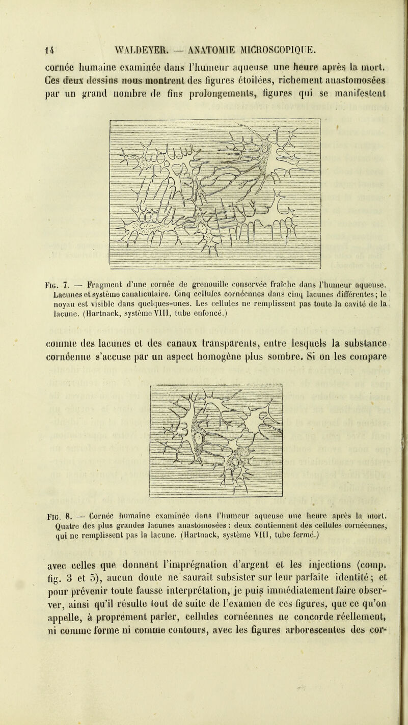 cornée humaine examinée dans l'humeur aqueuse une heure après la mort. Ces deux dessins nous montrent des figures étoilées, richement anastomosées par un grand nombre de fins prolongements, figures qui se manifestent FiG. 7. — Fragment d'une cornée de grenouille conservée fraîche dans Thumeur aqueuse. Lacunes et système canaliculaire. Cinq cellules cornéennes dans cinq lacunes différentes; le noyau est visible dans quelques-unes. Les cellules ne remplissent pas toute la cavité de la ', lacune. (Hartnack, système VIII, tube enfoncé.) comme des lacunes et des canaux transparents^ entre lesquek la substance cornéenne s'accuse par un aspect homogène plus sombre. Si on les compare FiG. 8. — Cornée humaine examinée dans l'humeur aqueuse une heure après la mort. Quatre des plus grandes lacunes anastomosées : deux Contiennent des cellules cornéennes, qui ne remplissent pas la lacune. (Hartnack, système VIII, tube fermé.) avec celles que donnent l'imprégnation d'argent et les injections (comp» fig. 3 et 5), aucun doute ne saurait subsister sur leur parfaite identité ; et pour prévenir toute fausse interprétation, je puis immédiatement faire obser- ver, ainsi qu'il résulte tout de suite de l'examen de ces figures, que ce qu'on appelle, à proprement parler, cellules cornéennes ne concorde réellement, ni comme forme ni comme contours^ avec les figures arborescentes des cor-