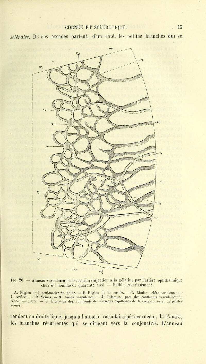 sclérales. De ces arcades partent, d'un côté, les petites brandies qui se FiG. ^0. — Anneau vasculaire péri-cornéen (injection à la gélatine par l'artère ophthalniiquc chez un hunniic de quarante ans). — Faible grossissement. A. Région de la conjonctive du bulbe. — B. Piégioa de lu cornée. — C. Limite scléro-coniéenno. — i. Artères. — 2. Veines. — 3. Anses vasculaires. — 4. Dilatation près des confluents vasculaires du réseau ainiulaire. — 5. Dilatation des confluents de vaisseaux capillaires de la conjonctive et de petites veines. rendent en droite ligne, jusqirà l'anneau vasculaire péri-cornéen; de l'autre, les branches récurrentes qui se dirigent vers la conjonctive. L'anneau