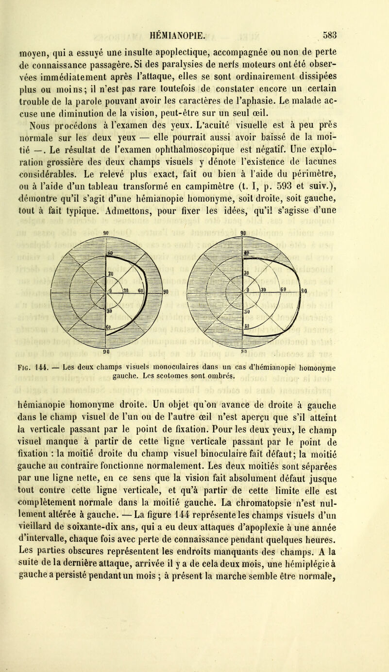 moyen, qui a essuyé une insulte apoplectique, accompagnée ou non de perte de connaissance passagère. Si des paralysies de nerfs moteurs ont été obser- vées immédiatement après l'attaque, elles se sont ordinairement dissipées plus ou moins; il n'est pas rare toutefois de constater encore un certain trouble de la parole pouvant avoir les caractères de l'aphasie. Le malade ac- cuse une diminution de la vision, peut-être sur un seul œil. Nous procédons à Texamen des yeux. L'acuité visuelle est à peu près normale sur les deux yeux — elle pourrait aussi avoir baissé de la moi- tié —. Le résultat de l'examen ophthalmoscopique est négatif. Une explo- ration grossière des deux champs visuels y dénote l'existence de lacunes considérables. Le relevé plus exact, fait ou bien à l'aide du périmètre, ou à l'aide d'un tableau transformé en campimètre (t. I, p. 593 et suiv.), démontre qu'il s'agit d'une hémianopie homonyme, soit droite, soit gauche, tout à fait typique. Admettons, pour fixer les idées, qu'il s'agisse d'une FiG. 144. — Les deux champs visuels monoculaires dans un cas d'hémianopie homonyme gauche. Les scotomes sont ombrés. hémianopie homonyme droite. Un objet qu'on avance de droite à gauche dans le champ visuel de l'un ou de l'autre œil n'est aperçu que s'il atteint la verticale passant par le point de fixation. Pour les deux yeux, le champ visuel manque à partir de cette ligne verticale passant par le point de fixation : la moitié droite du champ visuel binoculaire fait défaut; la moitié gauche au contraire fonctionne normalement. Les deux moitiés sont séparées par une ligne nette, en ce sens que la vision fait absolument défaut jusque tout contre cette ligne verticale, et qu'à partir de cette limite elle est complètement normale dans la moitié gauche. La chromatopsie n'est nul- lement altérée à gauche. —La figure 144 représente les champs visuels d'un vieillard de soixante-dix ans, qui a eu deux attaques d'apoplexie à une année d'intervalle, chaque fois avec perte de connaissance pendant quelques heures. Les parties obscures représentent les endroits manquants des champs. A la mile de la dernière attaque, arrivée il y a de cela deux mois, une hémiplégie à gauche a persisté pendant un mois ; à présent la marche semble être normale,