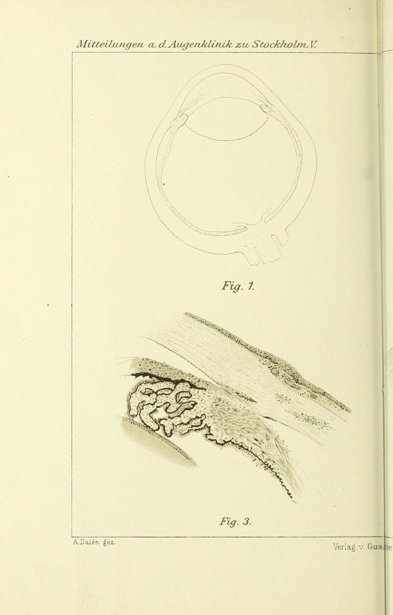 MiMeihatgerv a. d. Augenklinik zio Stockholnv. V. A.Daien gez.