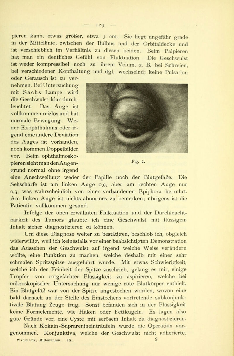 Fig. 2. pieren kann, etwas größer, etwa 3 cm. Sie liegt ungefähr grade in der Mittellinie, zwischen der Bulbus und der Orbitaldecke und ist verschieblich im Verhältnis zu diesen beiden. Beim Palpieren hat man ein deutliches Gefühl von Fluktuation. Die Geschwulst ist weder kompressibel noch zu ihrem Volum, z. B. bei Schreien, bei verschiedener Kopfhaltung und dg]., wechselnd; keine Pulsation oder Geräusch ist zu ver- nehmen. Bei Untersuchung mit Sachs Lampe wird die Geschwulst klar durch- leuchtet. Das Auge ist vollkommen reizlos und hat normale Bewegung. We- der Exophthalmus oder ir- gend eine andere Deviation des Auges ist vorhanden, noch kommen Doppelbilder vor. Beim ophthalmosko- pieren sieht man den Augen- grund normal ohne irgend eine Anschwellung weder der Papille noch der Blutgefäße. Die Sehschärfe ist am linken Auge 0,9, aber am rechten Auge nur 0,3, was wahrscheinlich von einer vorhandenen Epiphora herrührt. Am linken Ange ist nichts abnormes zu bemerken; übrigens ist die Patientin vollkommen gesund. Infolge der oben erwähnten Fluktuation und der Durchleucht- barkeit des Tumors glaubte ich eine Geschwulst mit flüssigem Inhalt sicher diagnostizieren zu können. Um diese Diagnose weiter zu bestätigen, beschloß ich, obgleich widerwillig, weil ich keinesfalls vor einer beabsichtigten Demonstration das Aussehen der Geschwulst auf irgend welche Weise verändern wollte, eine Punktion zu machen, welche deshalb mit einer sehr schmalen Spritzspitze ausgeführt wurde. Mit etwas Schwierigkeit, welche ich der Feinheit der Spitze zuschrieb, gelang es mir, einige Tropfen von rotgefärbter Flüssigkeit zu aspirieren, welche bei mikroskopischer Untersuchung nur wenige rote Blutkörper enthielt. Ein Blutgefäß war von der Spitze angestochen worden, wovon eine bald darnach an der Stelle des Einstechens vortretende subkonjunk- tivale Blutung Zeuge trug. Sonst befanden sich in der Flüssigkeit keine Formelemente, wie Haken oder Fettkugeln. Es lagen also gute Gründe vor, eine Cyste mit serösem Inhalt zu diagnostizieren. Nach Kokain-Suprarenineinträufeln wurde die Operation vor- genommen. Konjunktiva, welche der Geschwulst nicht adherierte, Widniark, Mitteilungen. IX. 9