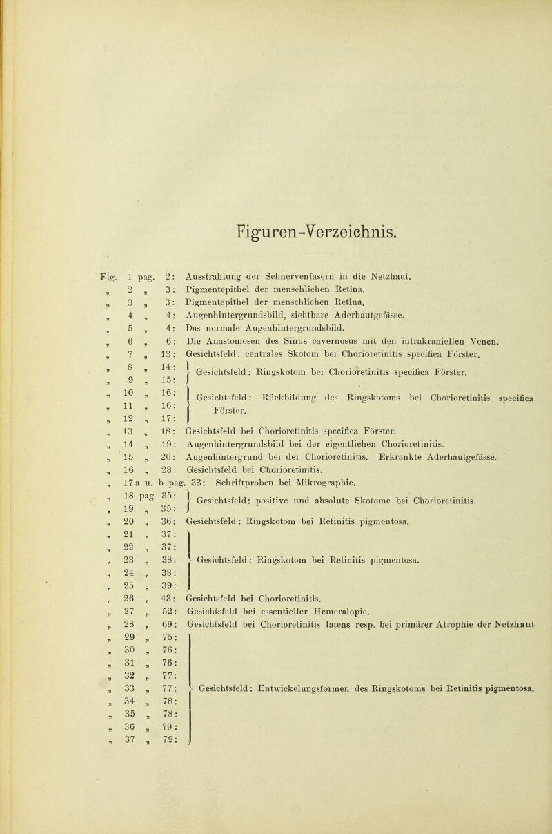 Figuren-Verzeichnis. 1 pag. 2 ^ 3 „ 4 . 5 „ 6 . 7 „ 8 „ 9 . 10 „ 11 . 12 „ 13 „ 14 „ 15 „ 16 „ 17a u. 18 pag. 19 . 20 „ 21 „ 22 , 23 „ 24 „ 25 , 26 „ 27 „ 28 „ 29 „ 30 „ 31 . 32 „ 33 „ 34 „ 35 „ 36 „ 37 « 2: 3: 3: 4: 4: 6: 13: 14: 15: 16: 16: 17: 18: 19: 20: 28: b pag, 35 35 36 37 37 38 38 39 43 52 69 75 76 76 77 77 78 78 79 79 Ausstrahlung der Sebnervenfasern in die Netzhaut. Pigmentepithel der menschlichen Retina. Pigmentepithel der menschlichen Retina. Augenhintergrundsbild, sichtbare Aderhautgefässe. Das normale Augenhintergrundsbild. Die Anastomosen des Sinus cavernosus mit den intrakraniellen Venen. Gesichtsfeld: centrales Skotom bei Chorioretinitis specifica Förster. 1 Gesichtsfeld: Eingskotom bei Chorioretinitis specifica Förster. Gesichtsfeld Förster. Rückbildung des Ringskotoms bei Chorioretinitis specifica Gesichtsfeld bei Chorioretinitis specifica Förster. Augenhintergrundsbild bei der eigentlichen Chorioretinitis. Augenhintergrund bei der Chorioretinitis. Erkrankte Aderhautgefässe. Gesichtsfeld bei Chorioretinitis. , 33: Schriftproben bei Miki'ographie. I Gesichtsfeld: positive und absolute Skotome bei Chorioretinitis. Gesichtsfeld: Ringskotom bei Retinitis pigmentosa. Gesichtsfeld: Ringskotom bei Retinitis pigmentosa. Gesichtsfeld bei Chorioretinitis. Gesichtsfeld bei essentieller Hemeralopie. Gesichtsfeld bei Chorioretinitis latens resp. bei primärer Atrophie der Netzhaut Gesichtsfeld: Entwickelungsformen des Ringskotoms bei Retinitis pigmentosa.