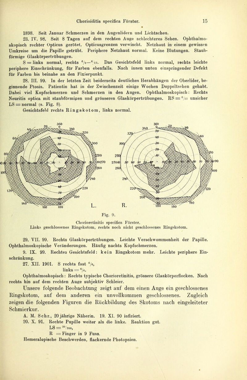 <t 1898. Seit Januar Schmerzen in den Augenlidern und Lichtscheu. 23. IV. 98. Seit 8 Tagen auf dem rechten Auge schlechteres Sehen. Ophthalmo- skopisch rechter Opticus gerötet. Opticusgrenzen verwischt. Netzhaut in einem gewissen Umkreise um die Papille getrübt. Periphere Netzhaut normal. Keine Blutungen. Staub- förmige Glaskörpertrübungen. S = links normal, rechts ^/9—^;'i2. Das Gesichtsfeld links normal, rechts leichte periphere Einschränkung, für Farben ebenfalls. Nach innen unten einspriugender Defekt für Farben bis beinahe an den Fixierpunkt. 28. III. 99. In der letzten Zeit beiderseits deutliches Herabhängen der Oberlider, be- ginnende Ptosis. Patientin hat in der Zwischenzeit einige Wochen Doppeltsehen gehabt. Dabei viel Kopfschmerzen und Schmerzen in den Augen. Ophthalmoskopisch: Rechts Neuritis optica mit staubförmigen und grösseren Glaskörpertrübungen. RS = ^/v2 unsicher LS = normal (s. Fig. 8). Gesichtsfeld rechts Ringskotom, links normal. i280 28( U27O 270« (260 26{ 160 180 L. R Fig. 9. Chorioretinitis specifica Förster. Links geschlossenes Ringskotom, rechts noch nicht geschlossenes Ringskotom. 29. YII. 99. Rechts Glaskörpertrübungen. Leichte Verschwommenheit der Papille. Ophthalmoskopische Veränderungen. Häufig nachts Kopfschmerzen. 9. IX. 99. Rechtes Gesichtsfeld: kein Ringskotom mehr. Leichte periphere Ein- schränkung. 27. XIL 1901. S rechts fast Ve, links = ^6. Ophthalmoskopisch: Rechts typische Chorioretinitis, grössere Glaskörperfi^ocken. Nach rechts hin auf dem rechten Auge subjektiv Schleier. Unsere folgende Beobachtung zeigt auf dem einen Auge ein geschlossenes Eingskotom, auf dem anderen ein unvollkommen geschlossenes. Zugleich zeigen die folgenden Figuren die Rückbildung des Skotoms nach eingeleiteter Schmierkur. A. M. Sehr., 20jährige Näherin. 19. XI. 90 infiziert. 20. X. 91. Rechte Pupille weiter als die linke. Reaktion gut. LS = 20/200, R = Finger in 9 Fuss. Hemeralopische Beschwerden, flackernde Photopsien.