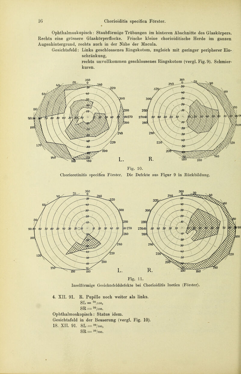 Ophthalmoskopisch: Staubförmige Trübungen im hinteren Abschnitte des Grlaskörpers. Rechts eine grössere Glaskörperflocke. Frische kleine chorioiditische Herde im ganzen Augenhintergrund, rechts auch in der Nähe der Macula. Gesichtsfeld: Links geschlossenes Ringskotom, zugleich mit geringer peripherer Ein- schränkung, rechts unvollkommen geschlossenes Ringskotom (vergl. Fig. 9). Schmier- kuren. '91 Fig. 10. Chorioretinitis specifica Förster. Die Defekte aus Figur 9 in Kückbildung. 280 280 kö270 270 ffö '260 260 Fig. 11. Inselförmige Gesichtsfelddefekte bei Chorioiditis luetica (Förster). 4. XII. 91. R. Pupille noch weiter als links. SL = 20/100, SR = 20 ,,00. Ophthalmoskopisch: Status idem. Gesichtsfeld in der Besserung (vergl. Fig. 10). 18. XII. 91. SL = 20/100, SR ='^0/200.
