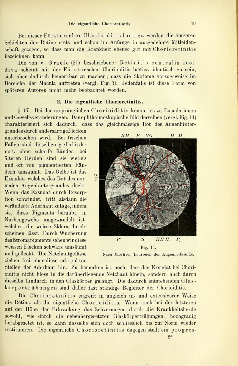 Bei dieser Försterscheii Chorioiditis luetica werden die äusseren Schichten der Eetina stets und schon im Anfange in ausgedehnte Mitleiden- schaft gezogen, so dass man die Krankheit ebenso gut mit Chorioretinitis bezeichnen kann. Die von v. Graefe (20) beschriebene: Retinitis centralis reci- diva scheint mit der För st er sehen Chorioiditis luetica identisch zu sein, sich aber dadurch bemerkbar zu machen, dass die Skotome vorzugsweise im Bereiche der Macula auftreten (vergl. Fig. 7). Jedenfalls ist diese Form von späteren Autoren nicht mehr beobachtet worden. 2. Die eigentliche Chorioretinitis. § 17. Bei der ursprünglichen Chorioiditis kommt es zu Exsudationen und Gewebsveränderungen. Das ophthalmoskopische Bild derselben (vergl. Fig. 14) charakterisiert sich dadurch, dass das gleichmässige Rot des Augenhinter- grundes durch andersartigeFlecken unterbrochen wird. Bei frischen Fällen sind dieselben gelblich- rot, ohne scharfe Ränder, bei älteren Herden sind sie weiss und oft von pigmentierten Rän- dern umsäumt. Das Gelbe ist das Exsudat, welches das Rot des nor- malen Augenhintergrundes deckt. Wenn das Exsudat durch Resorp- tion schwindet, tritt alsdann die veränderte Aderhaut zutage, indem sie, ihres Pigments beraubt, in Narbengewebe umgewandelt ist, welches die weisse Sklera durch- scheinen lässt. Durch Wucherung des Stromapigments sehen wir diese weissen Flecken schwarz umsäumt und gefleckt. Die Netzhautgefässe ziehen frei über diese erkrankten Stellen der Aderhaut hin. Zu bemerken ist noch, dass das Exsudat bei Chori- oiditis nicht bloss in die darüberliegende Netzhaut hinein, sondern auch durch dieselbe hindurch in den Glaskörper gelangt. Die dadurch entstehenden Glas- körpertrübungen sind daher fast ständige Begleiter der Chorioiditis. Die Chorioretinitis ergreift in ungleich in- und extensiverer Weise die Retina, als die eigentliche Chorioiditis. Wenn auch bei der letzteren auf der Höhe der Erkrankung das Sehvermögen durch die Krankheitsherde sowohl, wie durch die nebenhergesetzten Glaskörpertrübungen, hochgradig herabgesetzt ist, so kann dasselbe sich doch schliesslich bis zur Norm wieder restituieren. Die eigentliche Chorioretinitis dagegen stellt ein progres- 2* HH P GG H H P' S HHH P, Fig. 14. Nach Michel, Lehrbuch der Augenheilkunde.