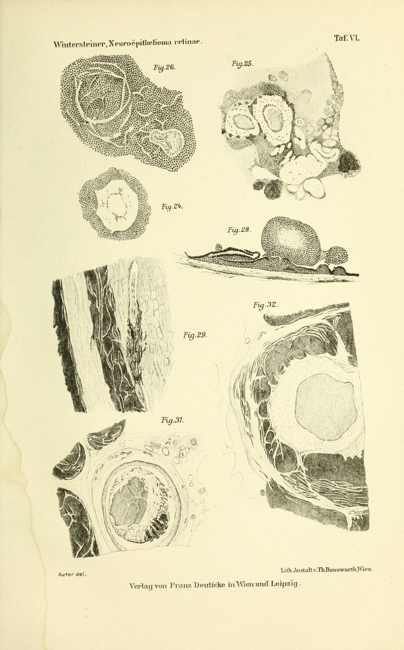 Autor dol. Lith. Anstaltv.Th.Bainiw'arth>Vien. Tei^ag von PivrnzTJ eitticke infW^emmS Leipzig.