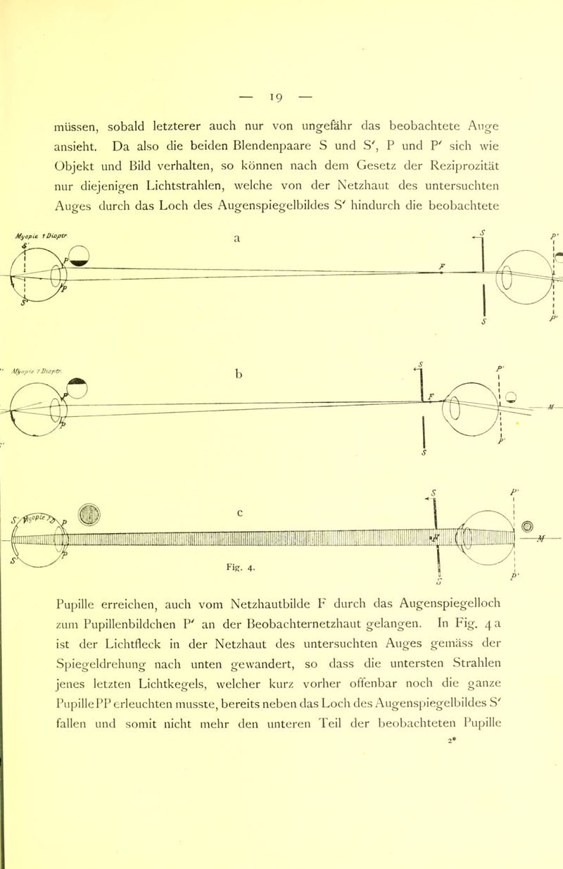 müssen, sobald letzterer auch nur von ungefähr das beobachtete Auge ansieht. Da also die beiden Blendenpaare S und S', P und P' sich wie Objekt und Bild verhalten, so können nach dem Gesetz der Reziprozität nur diejenigen Lichtstrahlen, welche von der Netzhaut des untersuchten Auges durch das Loch des Augenspiegelbildes S' hindurch die beobachtete T Dioptr Pupille erreichen, auch vom Netzhautbilde F durch das Augenspiegelloch zum Pupillenbildchen P' an der Beobachternetzhaut gelangen. In Fig. 4 a ist der Lichtfleck in der Netzhaut des untersuchten Auges gemäss der Spiegeldrehung nach unten gewandert, so dass die untersten Strahlen jenes letzten Lichtkegels, welcher kurz vorher offenbar noch die ganze PupillePP erleuchten musste, bereits neben das Loch des Augenspiegelbildes S' fallen und somit nicht mehr den unteren Teil der beobachteten Pupille 2*