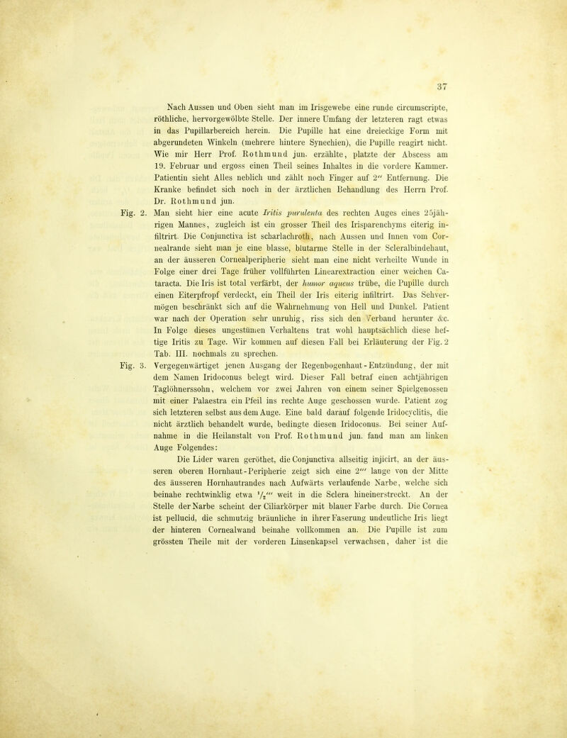 Nach Aussen und üben sieht man im Irisgewebe eine runde circumscripte, röthliche, hervorgewölbte Stelle. Der innere Umfang der letzteren ragt etwas in das Pupillarbereich herein. Die Pupille hat eine dreieckige Form mit abgerundeten Winkeln (mehrere hintere Synechien), die Pupille reagirt nicht. Wie mir Herr Prof. Rothmund jun. erzählte, platzte der Abscess am 19. Februar und ergoss einen Theil seines Inhaltes in die vordere Kammer. Patientin sieht Alles neblich und zählt noch Finger auf 2 Entfernung. Die Kranke befindet sich noch in der ärztlichen Behandlung des Herrn Prof. Dr. Rothmund jun. Fig. 2. Man sieht hier eine acute Iritis purulenta des rechten Auges eines 25jäh- rigen Mannes, zugleich ist ein grosser Theil des Irisparenchyms eiterig in- filtrirt. Die Conjunctiva ist scharlachroth, nach Aussen und Innen vom Gor- nealrande sieht man je eine blasse, blutarme Stelle in der Scleralbindehaut, an der äusseren Coruealperipherie sieht man eine nicht verheilte Wunde in Folge einer drei Tage früher vollführten Linearextraction einer weichen Ca- taracta. Die Iris ist total verfärbt, der hunior aquens trübe, die Pupille durch einen Eiterpfropf verdeckt, ein Theil der Iris eiterig infiltrirt. Das Sehver- mögen beschränkt sich auf die Wahrnehmung von Hell und Dunkel. Patient war nach der Operation sehr unruhig, riss sich den /erband herunter &c. In Folge dieses ungestümen Verhaltens trat wohl hauptsächlich diese hef- tige Iritis zu Tage. Wir kommen auf diesen Fall bei Erläuterung der Fig. 2 Tab. III. nochmals zu sprechen. Fig. 3. Vergegenwärtiget jenen Ausgang der Regenbogenhaut-Entzündung, der mit dem Namen Iridoconus belegt wird. Dieser Fall betraf einen achtjährigen Taglöhnerssohn, welchem vor zwei Jahren von einem seiner Spielgenossen mit einer Palaestra ein Pfeil ins rechte Auge geschossen wurde. Patient zog sich letzteren selbst aus dem Auge. Eine bald darauf folgende Iridocyclitis, die nicht ärztlich behandelt wurde, bedingte diesen Iridoconus. Bei seiner Auf- nahrae in die Heilanstalt von Prof. Rothmund jun. fand man am linken Auge Folgendes: Die Lider waren geröthet, die Conjunctiva allseitig injicirt, an der äus- seren oberen Hornhaut-Peripherie zeigt sich eine 2' lange von der Mitte des äusseren Hornhautrandes nach Aufwärts verlaufende Narbe, welche sich beinahe rechtwinklig etwa '/j' weit in die Sclera hineinerstreckt. An der Stelle der Narbe scheint der Ciliarkörper mit blauer Farbe durch. Die Cornea ist pellucid, die schmutzig bräunliche in ihrer Faserung undeutliche Iris liegt der hinteren Cornealwand beinahe vollkommen an. Die Pupille ist zum grössten Theile mit der vorderen Liuseukapsel verwachsen, daher ist die
