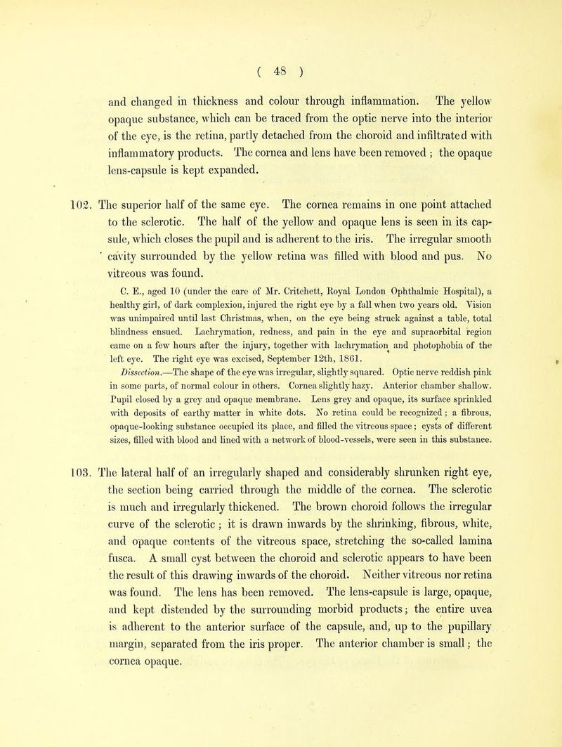 and changed in thickness and colour through inflammation. The yellow opaque substance, which can be traced from the optic nerve into the interior of the eye, is the retina, partly detached from the choroid and infiltrated with inflammatory products. The cornea and lens have been removed ; the opaque lens-capsule is kept expanded. 102. The superior half of the same eye. The cornea remains in one point attached to the sclerotic. The half of the yellow and opaque lens is seen in its cap- sule, which closes the pupil and is adherent to the iris. The irregular smooth cavity surrounded by the yellow retina was filled with blood and pus. No vitreous was found. C. E., aged 10 (under the care of Mr. Critchett, Royal London Ophthalmic Hospital), s healthy girl, of dark complexion, injured the right eye by a fall when two years old. Vision was unimpaired until last Christmas, when, on the eye being struck against a table, total blindness ensued. Lachrymation, redness, and pain in the eye and supraorbital region came on a few hours after the injury, together with lachrymation and photophobia of the left eye. The right eye was excised, September 12th, 1861. Dissection.—The shape of the eye was irregular, slightly squared. Optic nerve reddish pink in some parts, of normal colour in others. Cornea slightly hazy. Anterior chamber shallow. Pupil closed by a grey and opaque membrane. Lens grey and opaque, its surface sprinkled with deposits of earthy matter in white dots. No retina could be recognized; a fibrous, opaque-looking substance occupied its place, and filled the vitreous space; cysts of different sizes, filled with blood and lined with a network of blood-vessels, were seen in this substance. 103. The lateral half of an irregularly shaped and considerably shrunken right eye, the section being carried through the middle of the cornea. The sclerotic is much and irregularly thickened. The brown choroid follows the irregular curve of the sclerotic; it is drawn inwards by the shrinking, fibrous, white, and opaque contents of the vitreous space, stretching the so-called lamina fusca. A small cyst between the choroid and sclerotic appears to have been the result of this drawing inwards of the choroid. Neither vitreous nor retina was found. The lens has been removed. The lens-capsule is large, opaque, and kept distended by the surrounding morbid products; the entire uvea is adherent to the anterior surface of the capsule, and, up to the pupillary margin, separated from the iris proper. The anterior chamber is small; the cornea opaque.