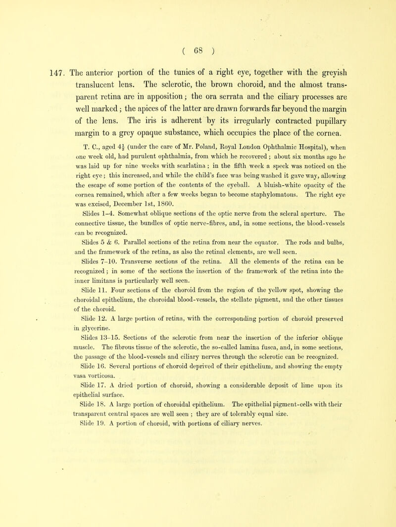 147. The anterior portion of the tunics of a right eye, together with the greyish translucent lens. The sclerotic, the brown choroid, and the almost trans- parent retina are in apposition; the ora serrata and the ciliary processes are well marked; the apices of the latter are drawn forwards far beyond the margin of the lens. The iris is adherent by its irregularly contracted pupillary margin to a grey opaque substance, which occupies the place of the cornea. T. C, aged 4| (under the care of Mr. Poland, Royal London Ophthalmic Hospital), when one week old, had purulent ophthalmia, from which he recovered; about six months ago he was laid up for nine weeks with scarlatina ; in the fifth week a speck was noticed on the right eye; this increased, and while the child's face was being washed it gave way, allowing the escape of some portion of the contents of the eyeball. A bluish-white opacity of the cornea remained, which after a few weeks began to become staphylomatous. The right eye was excised, December 1st, 1860. Slides 1-4. Somewhat oblique sections of the optic nerve from the scleral aperture. The connective tissue, the bundles of optic nerve-fibres, and, in some sections, the blood-vessels can be recognized. Slides 5 & 6. Parallel sections of the retina from near the equator. The rods and bulbs, and the framework of the retina, as also the retinal elements, are well seen. Slides 7-10. Transverse sections of the retina. All the elements of the retina can be recognized; in some of the sections the insertion of the framework of the retina into the inner limitans is particularly well seen. Slide 11. Four sections of the choroid from the region of the yellow spot, showing the choroidal epithelium, the choroidal blood-vessels, the stellate pigment, and the other tissues of the choroid. Slide 12. A large portion of retina, with the corresponding portion of choroid preserved in glycerine. Slides 13-15. Sections of the sclerotic from near the insertion of the inferior oblique muscle. The fibrous tissue of the sclerotic, the so-called lamina fusca, and, in some sections, the passage of the blood-vessels and ciliary nerves through the sclerotic can be recognized. Slide 16. Several portions of choroid deprived of their epithelium, and showing the empty vasa vorticosa. Slide 17. A dried portion of choroid, showing a considerable deposit of lime upon its epithelial surface. Slide 18. A large portion of choroidal epithelium. The epithelial pigment-cells with their transparent central spaces are well seen ; they are of tolerably equal size. Slide 19. A portion of choroid, with portions of ciliary nerves.