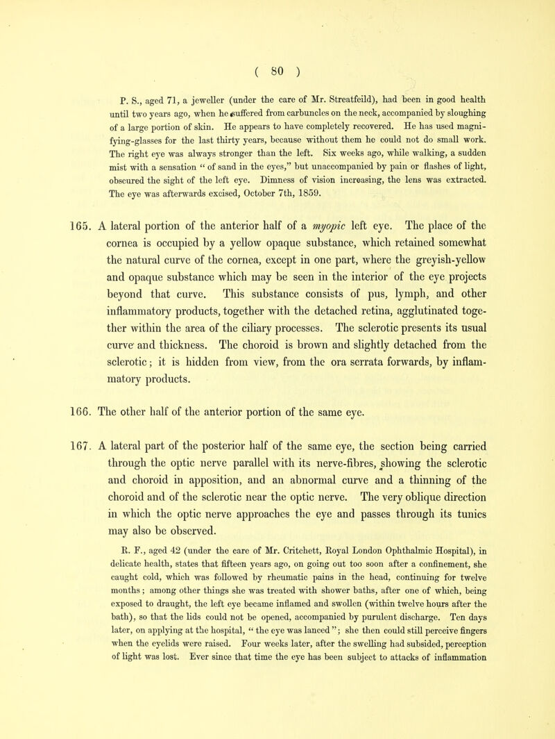 P. S., aged 71, a jeweller (under the care of Mr. Streatfeild), had been in good health until two years ago, when he suffered from carbuncles on the neck, accompanied by sloughing of a large portion of skin. He appears to have completely recovered. He has used magni- fying-glasses for the last thirty years, because without them he could not do small work. The right eye was always stronger than the left. Six weeks ago, while walking, a sudden mist with a sensation  of sand in the eyes, but unaccompanied by pain or flashes of light, obscured the sight of the left eye. Dimness of vision increasing, the lens was extracted. The eye was afterwards excised, October 7th, 1859. 165. A lateral portion of the anterior half of a myopic left eye. The place of the cornea is occupied by a yellow opaque substance, which retained somewhat the natural curve of the cornea, except in one part, where the greyish-yellow and opaque substance which may be seen in the interior of the eye projects beyond that curve. This substance consists of pus, lymph, and other inflammatory products, together with the detached retina, agglutinated toge- ther within the area of the ciliary processes. The sclerotic presents its usual curve and thickness. The choroid is brown and slightly detached from the sclerotic; it is hidden from view, from the ora serrata forwards, by inflam- matory products. 166. The other half of the anterior portion of the same eye. 167. A lateral part of the posterior half of the same eye, the section being carried through the optic nerve parallel with its nerve-fibres, showing the sclerotic and choroid in apposition, and an abnormal curve and a thinning of the choroid and of the sclerotic near the optic nerve. The very oblique direction in which the optic nerve approaches the eye and passes through its tunics may also be observed. R. F., aged 42 (under the care of Mr. Critchett, Eoyal London Ophthalmic Hospital), in delicate health, states that fifteen years ago, on going out too soon after a confinement, she caught cold, which was followed by rheumatic pains in the head, continuing for twelve months; among other things she was treated with shower baths, after one of which, being exposed to draught, the left eye became inflamed and swollen (within twelve hours after the bath), so that the lids could not be opened, accompanied by purulent discharge. Ten days later, on applying at the hospital,  the eye was lanced ; she then could still perceive fingers when the eyelids were raised. Four weeks later, after the swelling had subsided, perception of light was lost. Ever since that time the eye has been subject to attacks of inflammation