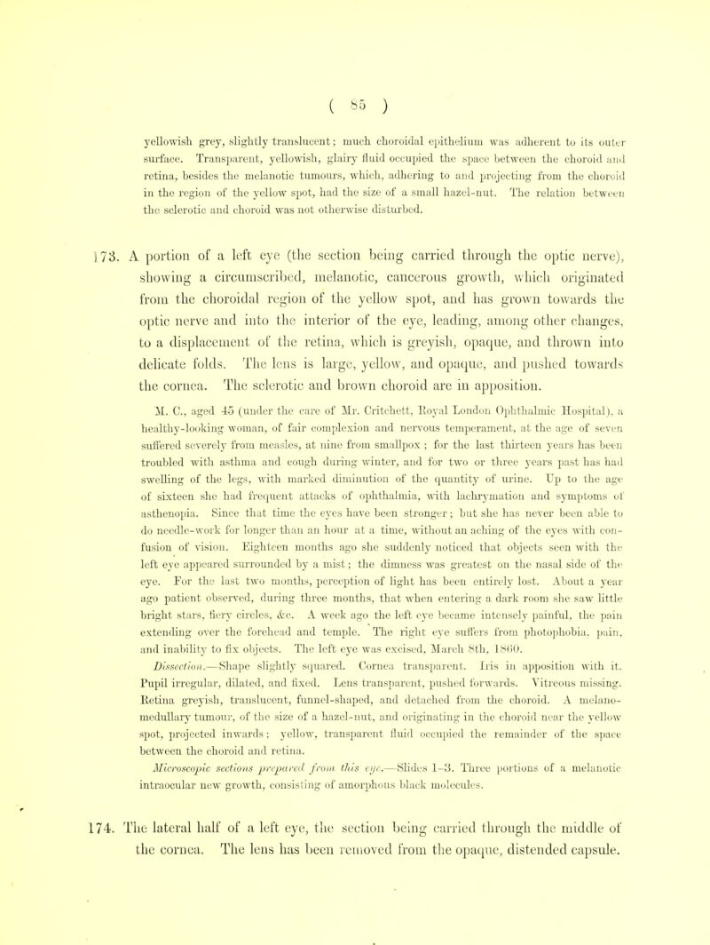 yellowish grey, slightly translucent; much choroidal epithelium was adherent to its outer surface. Transparent, yellowish, glairy fluid occupied the space between the choroid and retina, besides the melanotic tumours, which, adhering to and projecting from the choroid in the region of the yellow spot, had the size of a small hazel-nut. The relation between the sclerotic and choroid was not otherwise disturbed. s73. A portion of a left eye (the section being carried through the optic nerve), showing a circumscribed, melanotic, cancerous growth, which originated from the choroidal region of the yellow spot, and has grown towards the optic nerve and into the interior of the eye, leading, among other changes, to a displacement of the retina, which is greyish, opaque, and thrown into delicate folds. The lens is large, yellow, and opaque, and pushed towards the cornea. The sclerotic and brown choroid are in apposition. M. C, aged 45 (under the care of Mr. Critchett, Eoyal London Ophthalmic Hospital), a healthy-looking woman, of fair complexion and nervous temperament, at the age of seven suffered severely from measles, at nine from smallpox ; for the last thirteen years has been troubled with asthma and cough during winter, and for two or three years past has had swelling of the legs, with marked diminution of the quantity of urine. Up to the age of sixteen she had frequent attacks of ophthalmia, with lachrymation and symptoms of asthenopia. Since that time the eyes have been stronger; but she has never been able to do needle-work for longer than an hour at a time, without an aching of the eyes with con^- fusion of vision. Eighteen months ago she suddenly noticed that objects seen with the left eye appeared surrounded by a mist; the dimness was greatest on the nasal side of the eye. For the last two months, perception of light has been entirely lost. About a year ago patient observed, during three months, that when entering a dark room she saw little bright stars, fiery circles, ifec. A week ago the left eye became intensely painful, the pain extending over the forehead and temple. The right eye suffers from photophobia, pain, and inability to fix objects. The left eye was excised, March 8th, 1800. Dissection.—Shape slightly squared. Cornea transparent. Iris in apposition with it. Pupil irregular, dilated, and fixed. Lens transparent, pushed forwards. Vitreous missing. Retina greyish, translucent, funnel-shaped, and detached from the choroid. A melano- medullary tumour, of the size of a hazel-nut, and originating in the choroid near the yellow spot, projected inwards; yellow, transparent fluid occupied the remainder of the space between the choroid and retina. Microscopic sections prepared, from this eye.—Slides 1-3. Three portions of a melanotic intraocular new growth, consisting of amorphous black molecules. 174. The lateral half of a left eye, the section being carried through the middle of the cornea. The lens has been removed from the opaque, distended capsule.
