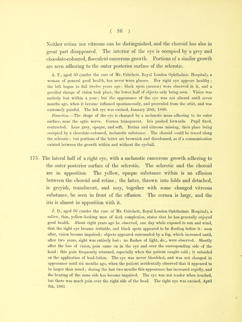 Neither retina nor vitreous can be distinguished, and the choroid has also in great part disappeared. The interior of the eye is occupied by a grey and chocolate-coloured, flocculent cancerous growth. Portions of a similar growth are seen adhering to the outer posterior surface of the sclerotic. A. T., aged 50 (under the care of Mr. Critchett, Royal London Ophthalmic Hospital), a woman of general good health, has never worn glasses. Her right eye appears healthy; the left began to fail twelve years ago; black spots (niuscae) were observed in it, and a peculiar change of vision took place, the lower half of objects only being seen. Vision was entirely lost within a year; but the appearance of the eye was not altered until seven months ago, when it became inflamed spontaneously, and protruded from the orbit, and was extremely painful. The left eye was excised, January 20th, 1860. Dissection.—The shape of the eye is changed by a melanotic mass adhering to its outer surface, near the optic nerve. Cornea transparent. Iris pushed forwards. Pupil fixed, contracted. Lens grey, opaque, and soft. Retina and vitreous missing, their place being occupied by a chocolate-coloured, melanotic substance. The choroid could be traced along the sclerotic ; but portions of the latter are brownish and discoloured, as if a communication existed between the growth within and without the eyeball. The lateral half of a right eye, with a melanotic cancerous growth adhering to the outer posterior surface of the sclerotic. The sclerotic and the choroid are in apposition. The yellow, opaque substance within is an effusion between the choroid and retina; the latter, thrown into folds and detached, is greyish, translucent, and may, together with some changed vitreous substance, be seen in front of the effusion. The cornea is large, and the iris is almost in apposition with it. J. D., aged 56 (under the care of Mr. Critchett, Royal London Ophthalmic Hospital), a sallow, thin, yellow-looking man of dark complexion, states that he has generally enjoyed good health. About eight years ago he observed, one day while exposed to sun and wind, that the right eye became irritable, and black spots appeared to be floating before it:' soon after, vision became impaired; objects appeared surrounded by a fog, which increased until, after two years, sight was entirely lost; no flashes of light, &c, were observed. Shortly after the loss of vision, pain came on in the eye and over the corresponding side of the head : this pain frequently returned, especially when the patient caught cold ; it subsided on the application of lead-lotion. The eye was never bloodshot, and was not changed in appearance until six months ago, when the patient accidentally observed that it appeared to be larger than usual; during the last two months this appearance has increased rapidly, and the hearing of the same side has become impaired. The eye was not tender when touched, but there was much pain over the right side of the head. The right eye was excised, April 9th, 1861.