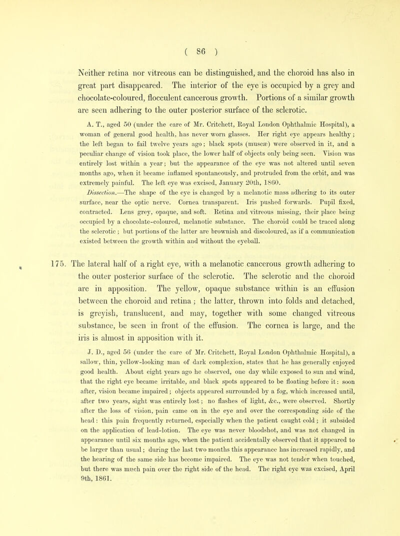 Neither retina nor vitreous can be distinguished, and the choroid has also in great part disappeared. The interior of the eye is occupied by a grey and chocolate-coloured, flocculent cancerous growth. Portions of a similar growth are seen adhering to the outer posterior surface of the sclerotic. A. T., aged 50 (under the care of Mr. Critchett, Royal London Ophthalmic Hospital), a woman of general good health, has never worn glasses. Her right eye appears healthy; the left began to fail twelve years ago; black spots (muscae) were observed in it, and a peculiar change of vision took place, the lower half of objects only being seen. Vision was entirely lost within a year; but the appearance of the eye was not altered until seven months ago, when it became inflamed spontaneously, and protruded from the orbit, and was extremely painful. The left eye was excised, January 20th, 1860. Dissection.—The shape of the eye is changed by a melanotic mass adhering to its outer surface, near the optic nerve. Cornea transparent. Iris pushed forwards. Pupil fixed, contracted. Lens grey, opaque, and soft. Retina and vitreous missing, their place being occupied by a chocolate-coloured, melanotic substance. The choroid could be traced along the sclerotic ; but portions of the latter are brownish and discoloured, as if a communication existed between the growth within and without the eyeball. 175. The lateral half of aright eye, with a melanotic cancerous growth adhering to the outer posterior surface of the sclerotic. The sclerotic and the choroid are in apposition. The yellow, opaque substance within is an effusion between the choroid and retina; the latter, thrown into folds and detached, is greyish, translucent, and may, together with some changed vitreous substance, be seen in front of the effusion. The cornea is large, and the iris is almost in apposition with it. J. D., aged 56 (under the care of Mr. Critchett, Royal London Ophthalmic Hospital), a sallow, thin, yellow-looking man of dark complexion, states that he has generally enjoyed good health. About eight years ago he observed, one day while exposed to sun and wind, that the right eye became irritable, and black spots appeared to be floating before it: soon after, vision became impaired; objects appeared surrounded by a fog, which increased until, after two years, sight was entirely lost; no flashes of light, <fcc, were observed. Shortly after the loss of vision, pain came on in the eye and over the corresponding side of the head: this pain frequently returned, especially when the patient caught cold; it subsided on the application of lead-lotion. The eye was never bloodshot, and was not changed in appearance until six months ago, when the patient accidentally observed that it appeared to be larger than usual; during the last two months this appearance has increased rapidly, and the hearing of the same side has become impaired. The eye was not tender when touched, but there was nmch pain over the right side of the head. The right eye was excised, April 9th, 1861.