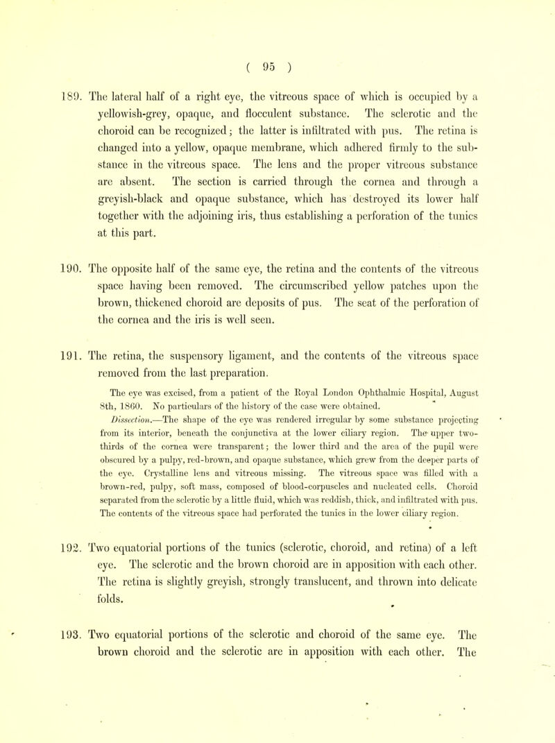 189. The lateral half of a right eye, the vitreous space of which is occupied by a yellowish-grey, opaque, and flocculent substance. The sclerotic and the choroid can be recognized; the latter is infiltrated with pus. The retina is changed into a yellow, opaque membrane, which adhered firmly to the sub- stance in the vitreous space. The lens and the proper vitreous substance are absent. The section is carried through the cornea and through a greyish-black and opaque substance, which has destroyed its lower half together with the adjoining iris, thus establishing a perforation of the tunics at this part. 190. The opposite half of the same eye, the retina and the contents of the vitreous space having been removed. The circumscribed yellow patches upon the brown, thickened choroid are deposits of pus. The seat of the perforation of the cornea and the iris is well seen. 191. The retina, the suspensory ligament, and the contents of the vitreous space removed from the last preparation. The eye was excised, from a patient of the Eoyal London Ophthalmic Hospital, August 8th, 1860. No particulars of the history of the case were obtained. Dissection.—The shape of the eye was rendered irregular by some substance projecting from its interior, beneath the conjunctiva at the lower ciliary region. The- upper two- thirds of the cornea were transparent; the lower third and the area of the pupil were obscured by a pulpy, red-brown, and opaque substance, which grew from the deeper parts of the eye. Crystalline lens and vitreous missing. The vitreous space was filled with a brown-red, pulpy, soft mass, composed of blood-corpuscles and nucleated cells. Choroid separated from the sclerotic by a little fluid, which was reddish, thick, and infiltrated with pus. The contents of the vitreous space had perforated the tunics in the lower ciliary region. • 192. Two equatorial portions of the tunics (sclerotic, choroid, and retina) of a left eye. The sclerotic and the brown choroid are in apposition with each other. The retina is slightly greyish, strongly translucent, and thrown into delicate folds. * 193. Two equatorial portions of the sclerotic and choroid of the same eye. The brown choroid and the sclerotic are in apposition with each other. The