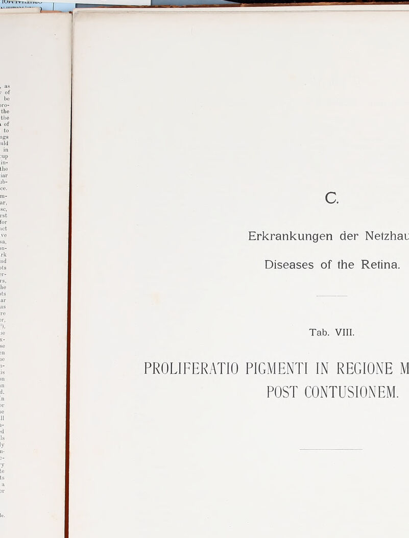 Erkrankungen der Netzhai Diseases of the Retina. Tab. VIII. PROLIFERATIO PIGMENTI IN REGIONE M POST CONTUSIONEM.